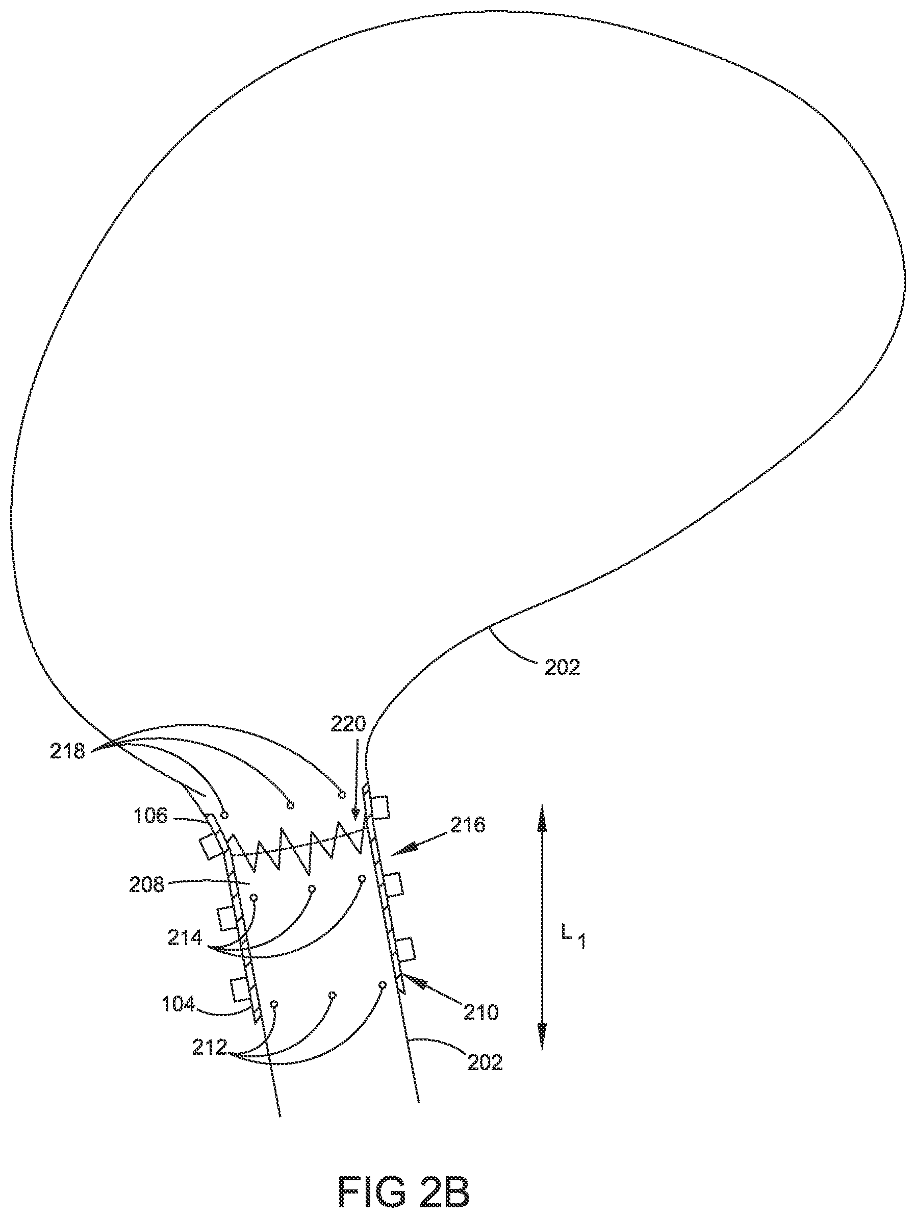 Patent US12324586 Figure 4 – Apparatus and methods for managing a shape of a junction between a bladder and urethra