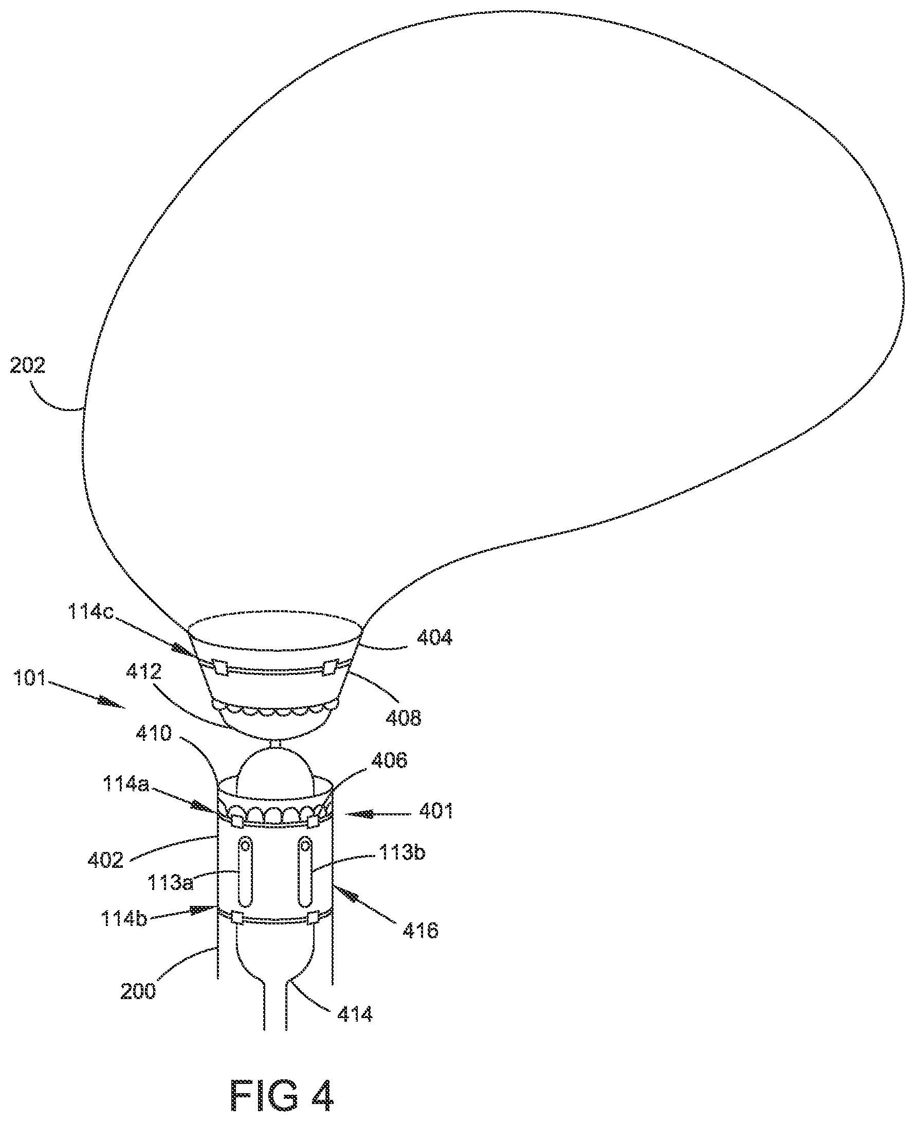 Patent US12324586 Figure 6 – Apparatus and methods for managing a shape of a junction between a bladder and urethra