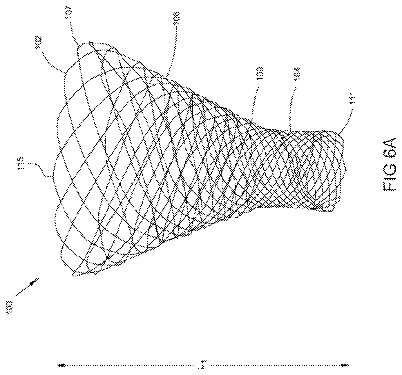 Patent US12324586 Figure 8 – Apparatus and methods for managing a shape of a junction between a bladder and urethra
