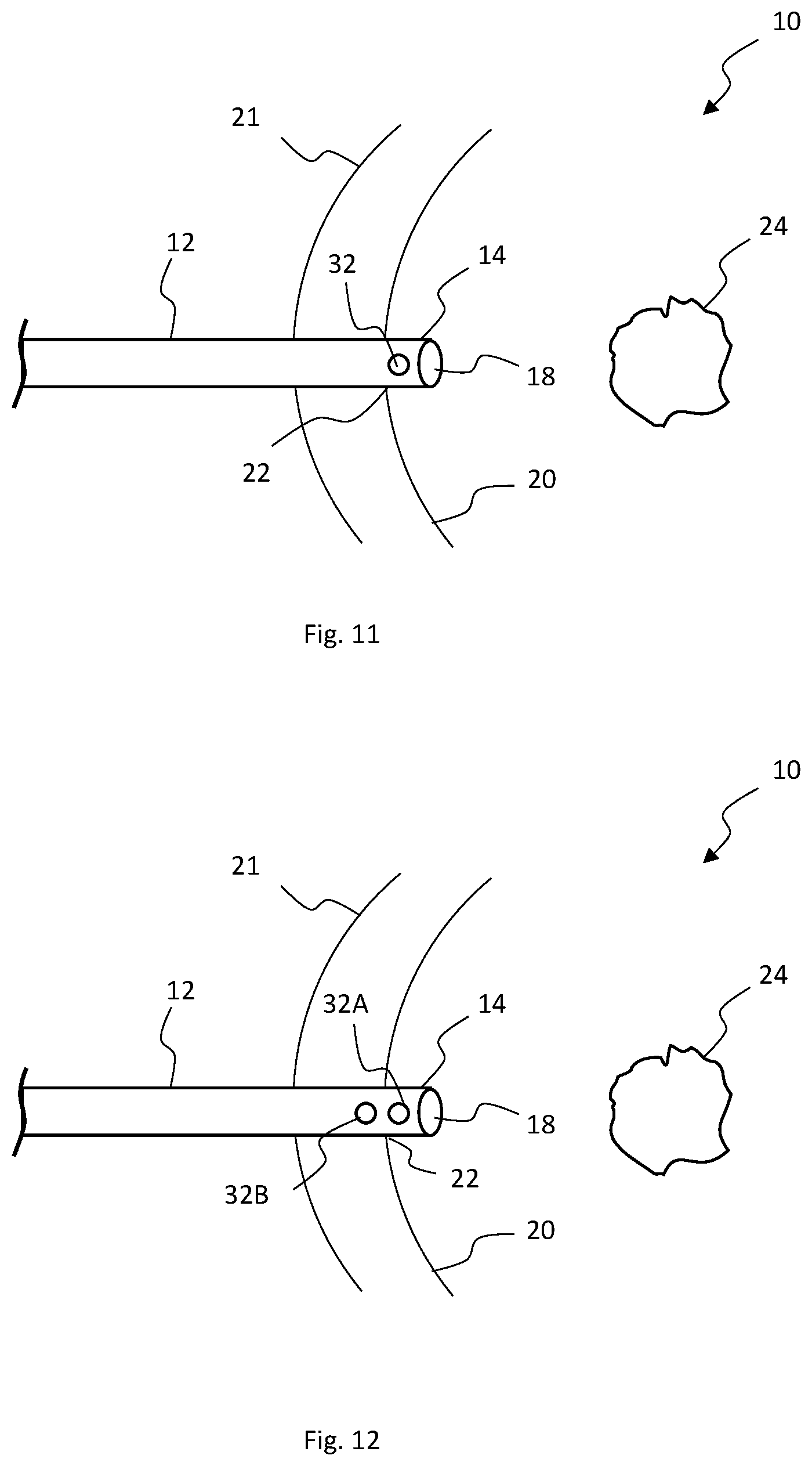 Patent US12324587 Figure 7 – Multistage bioabsorbable plug system