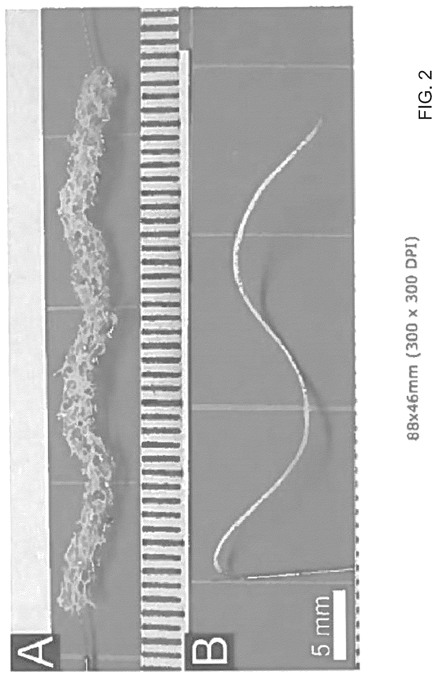 Patent US12324588 Figure 2 – Heated endovascular catheter injection device