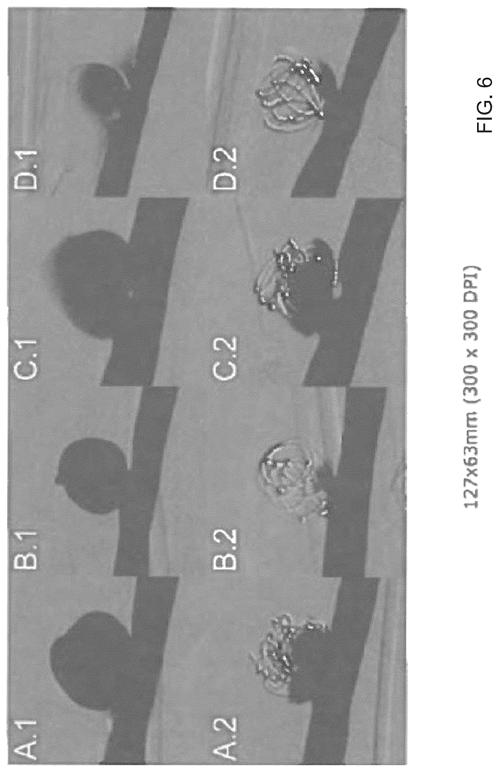 Patent US12324588 Figure 6 – Heated endovascular catheter injection device