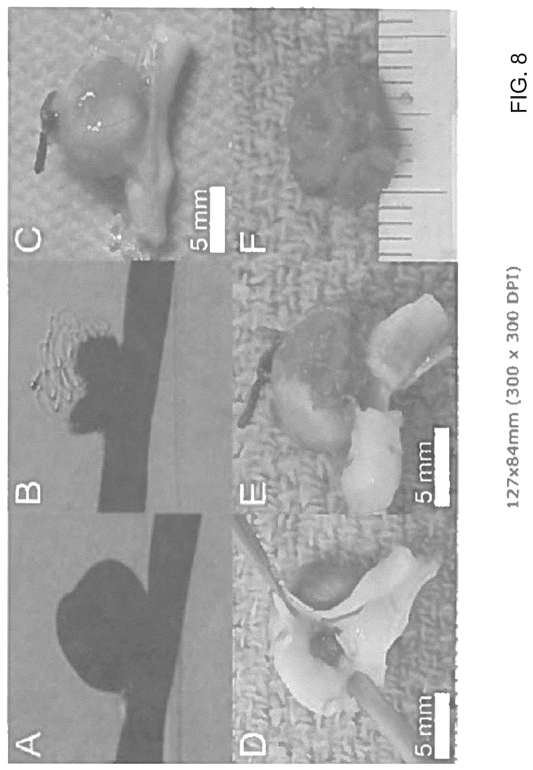Patent US12324588 Figure 8 – Heated endovascular catheter injection device