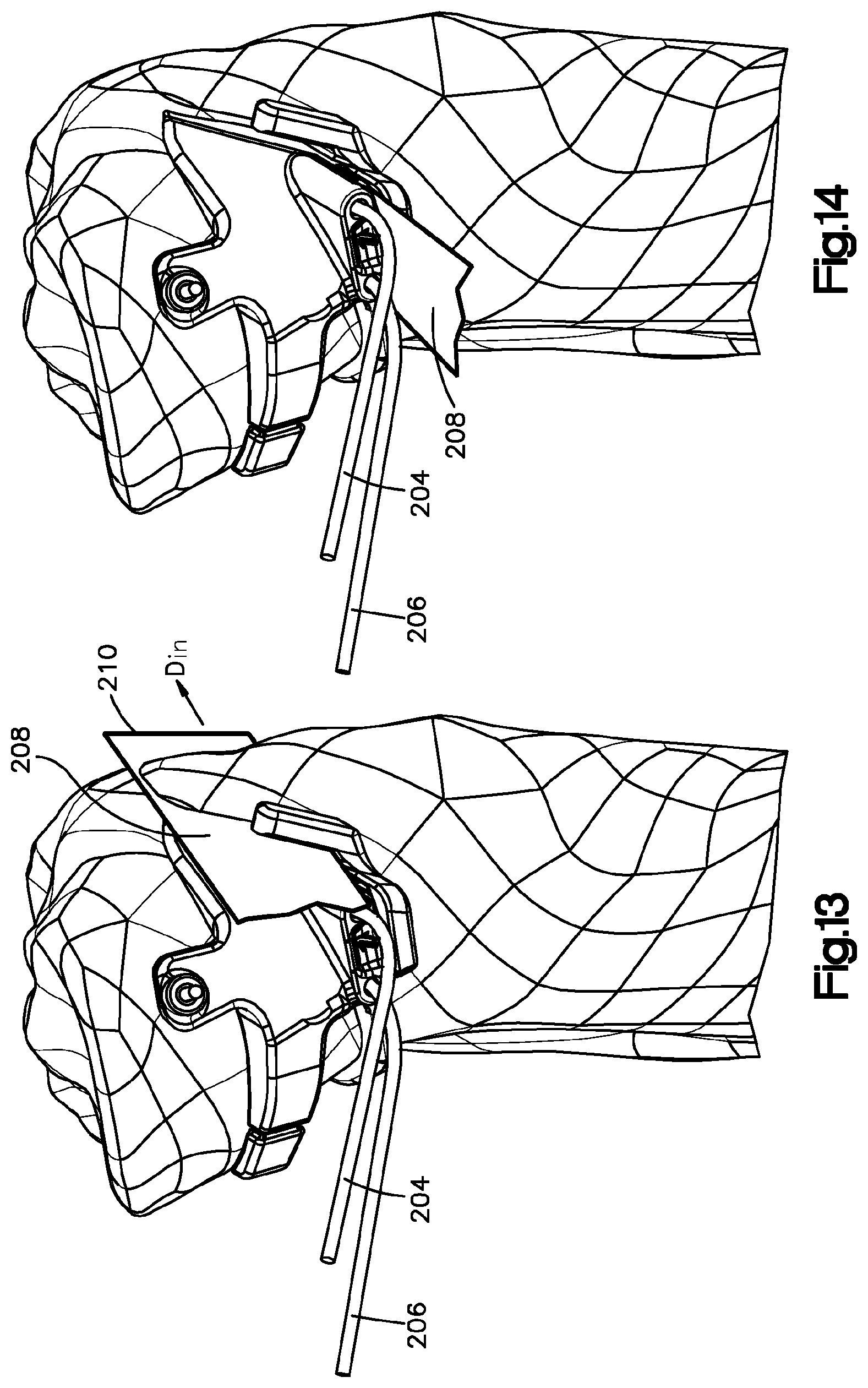 Patent US12324591 Figure 7 – Osteotomy guide
