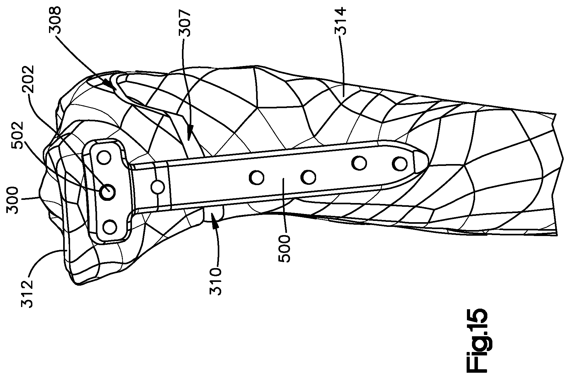 Patent US12324591 Figure 8 – Osteotomy guide