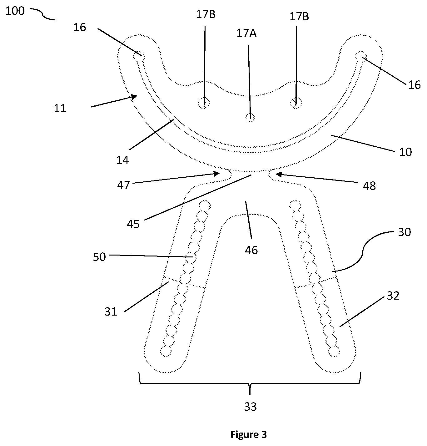 Patent US12324592 Figure 3 – Veterinary surgical guide