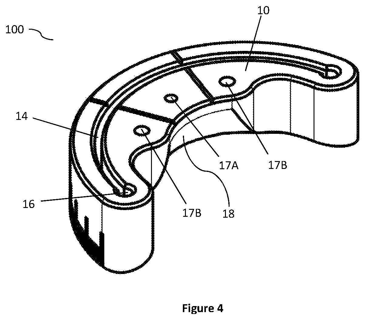 Patent US12324592 Figure 4 – Veterinary surgical guide