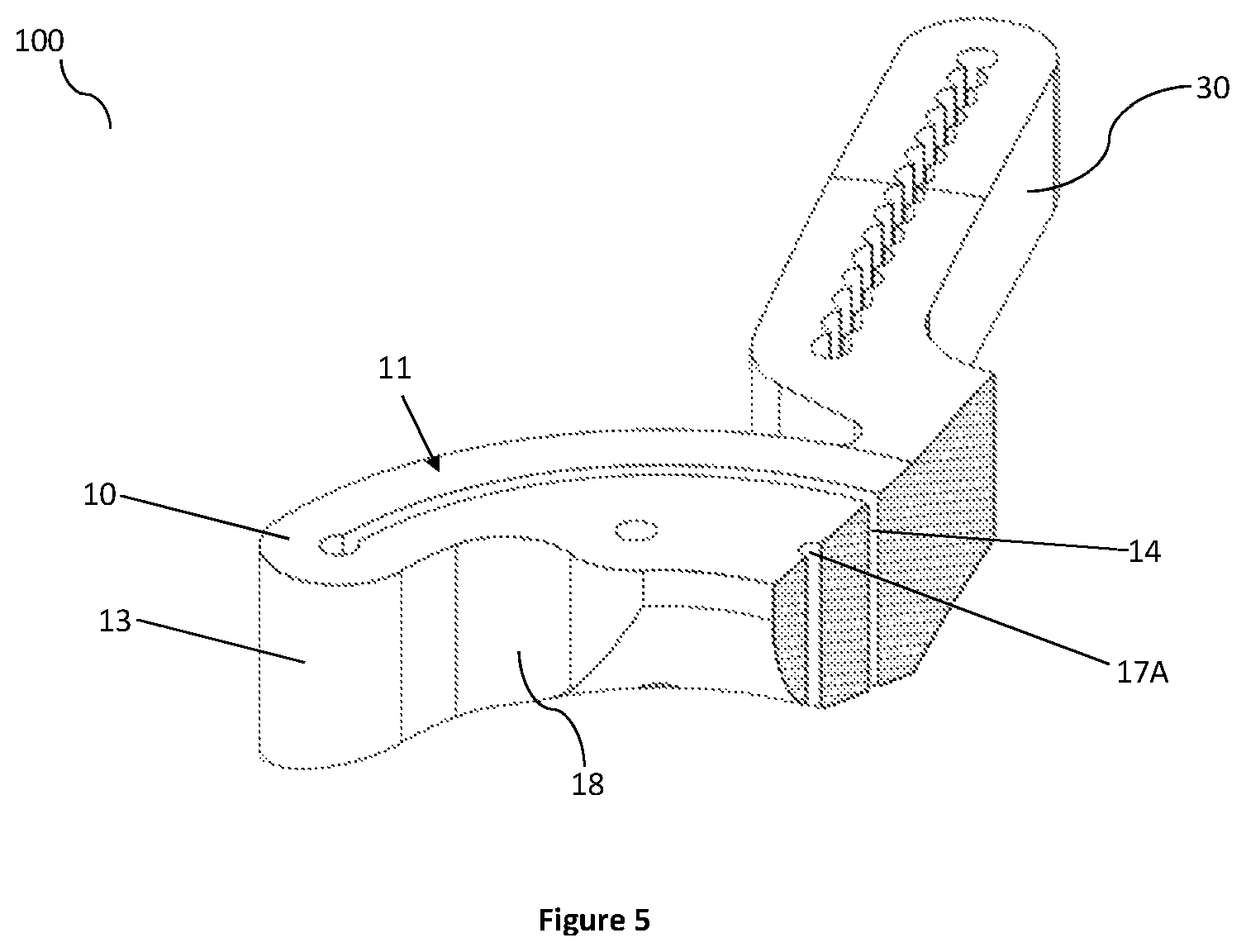 Patent US12324592 Figure 5 – Veterinary surgical guide