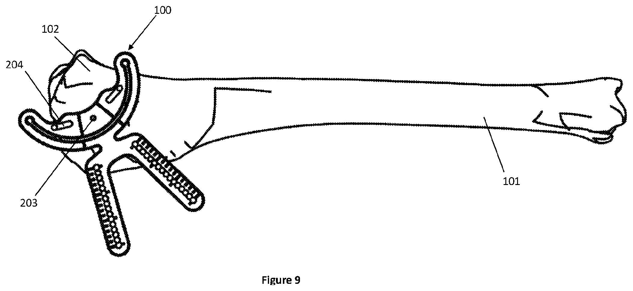 Patent US12324592 Figure 9 – Veterinary surgical guide