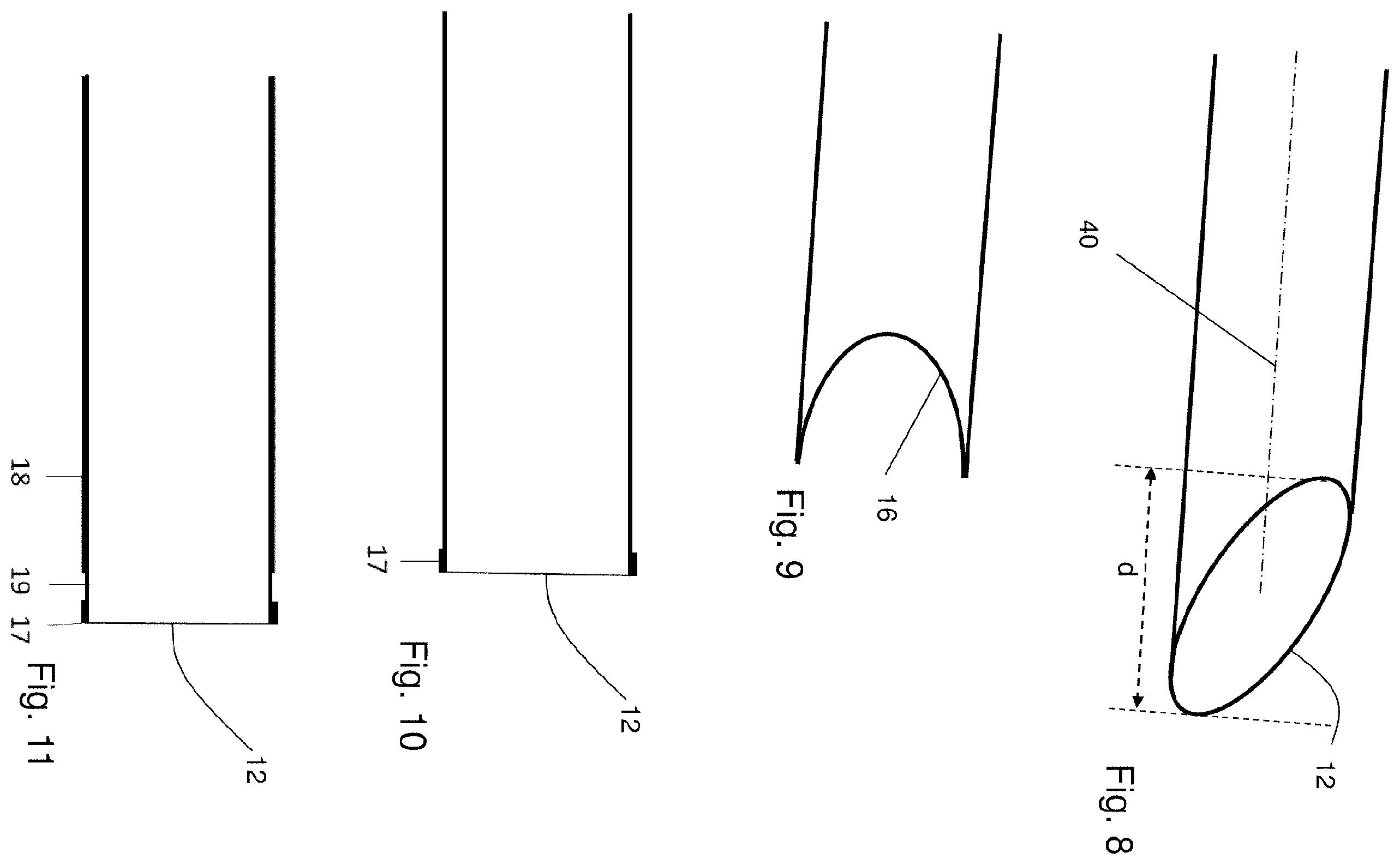 Patent US12324593 Figure 3 – Device and method for punching bone