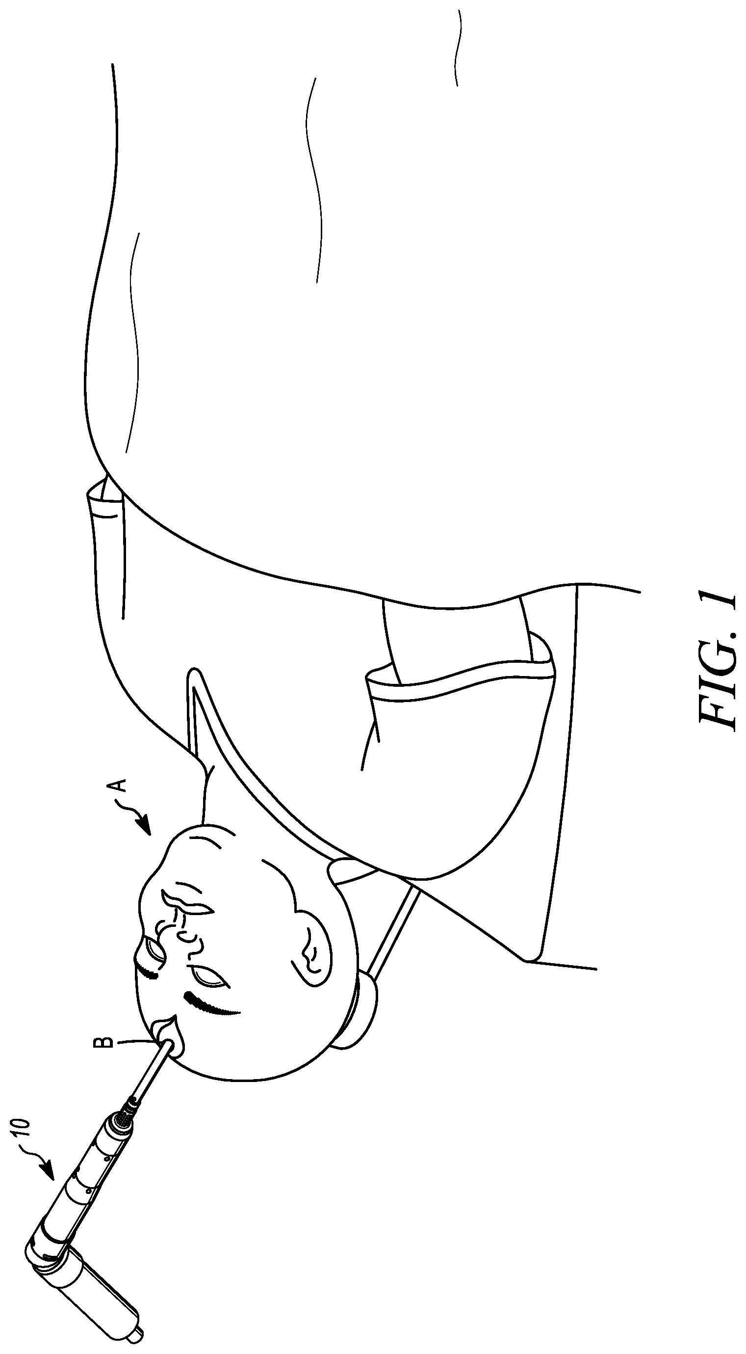 Patent US12324594 Figure 1 – Ultrasonic bone cutting device with integrated sensing
