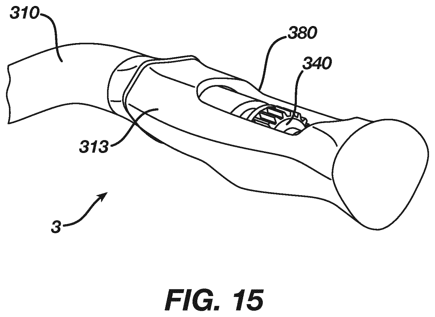 Patent US12324595 Figure 8 – Adjustable reamer driver and impactor, and methods of preparing said driver and impactor
