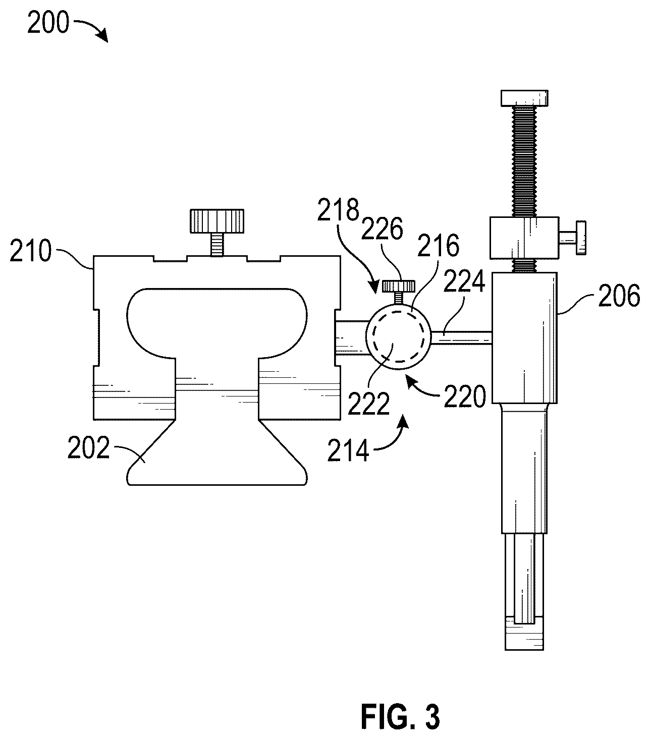 Patent US12324596 Figure 3 – Apparatus and bone cutting device for removal of bone tissue