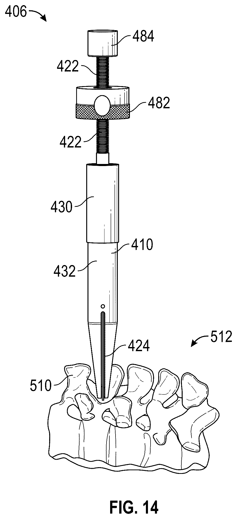Patent US12324596 Figure 14 – Apparatus and bone cutting device for removal of bone tissue