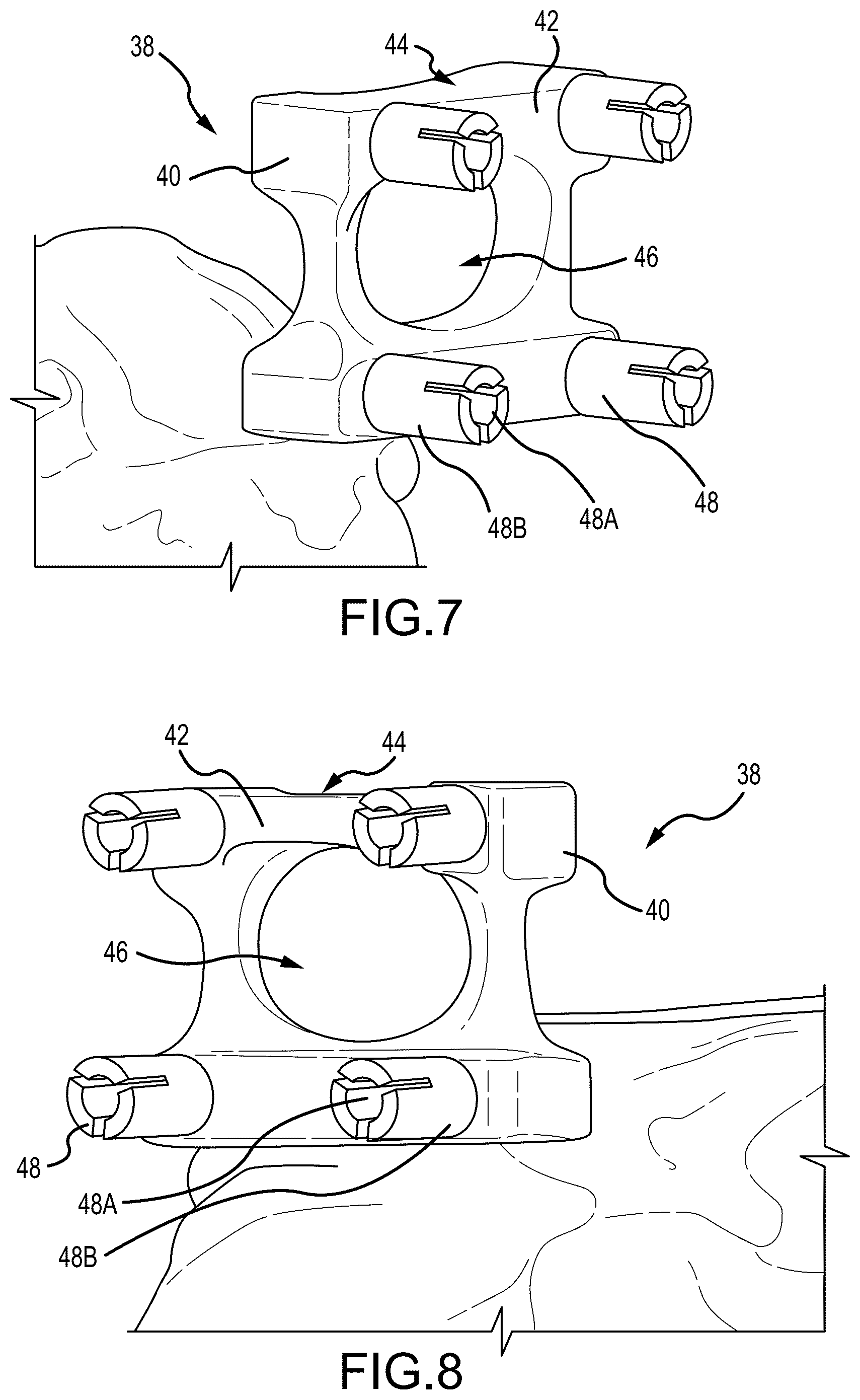 Patent US12324597 Figure 4 – Methods and systems for arthroplasty