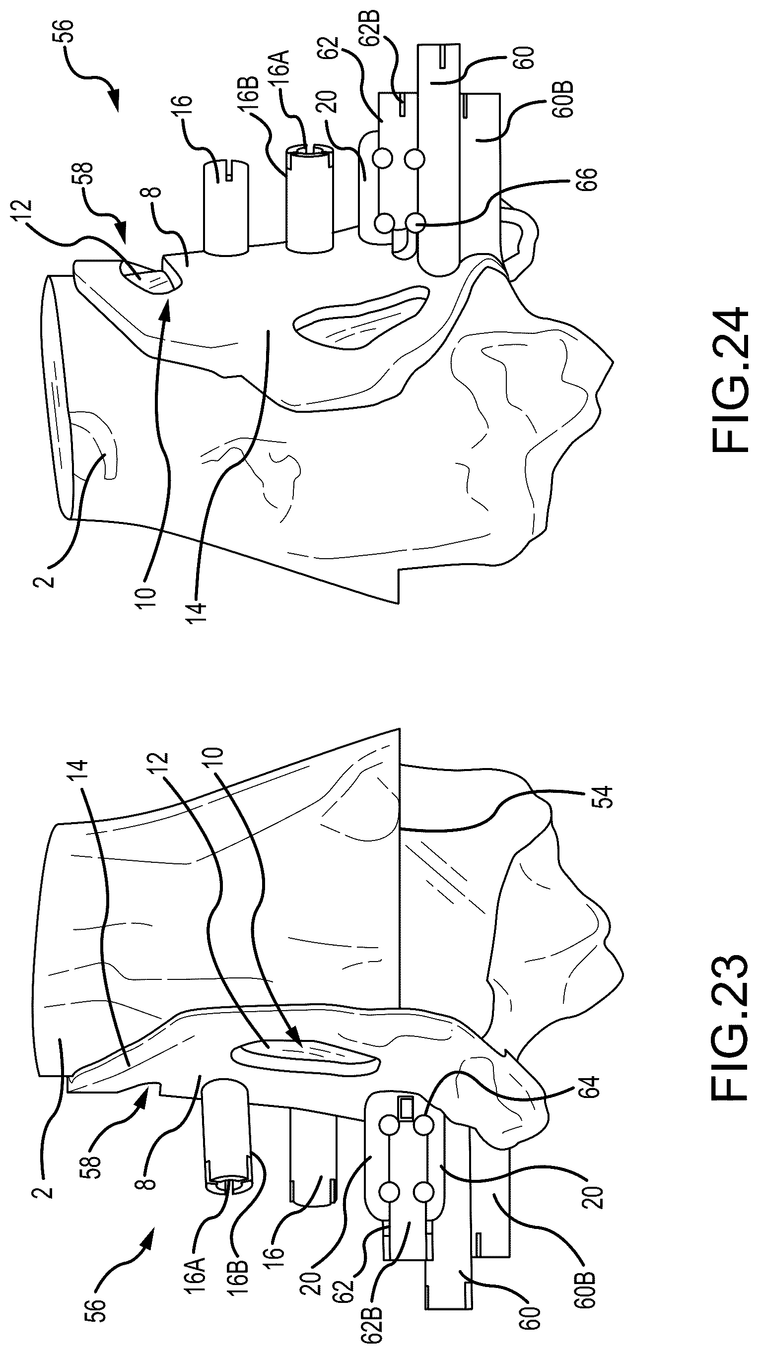 Patent US12324597 Figure 13 – Methods and systems for arthroplasty