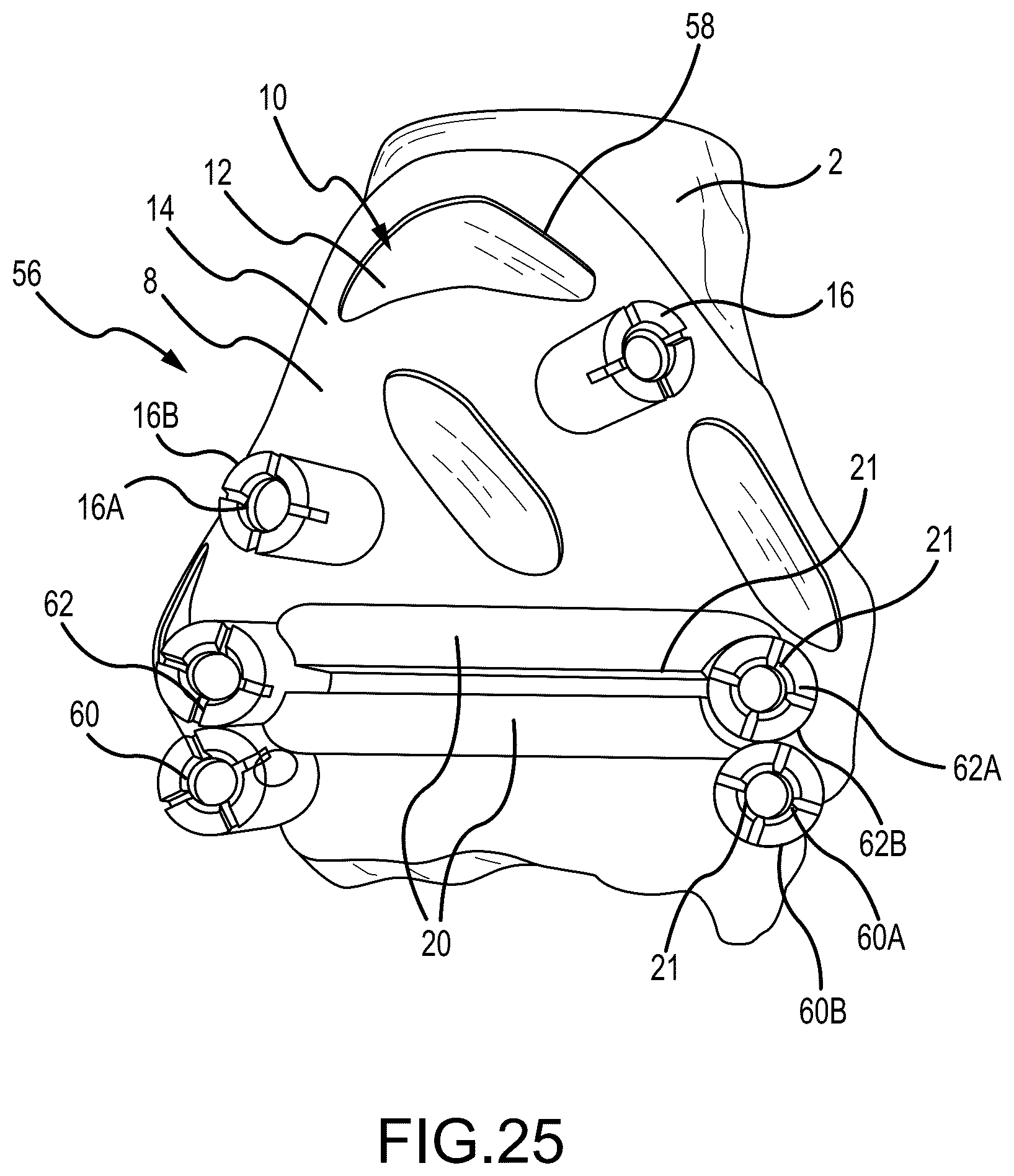 Patent US12324597 Figure 14 – Methods and systems for arthroplasty