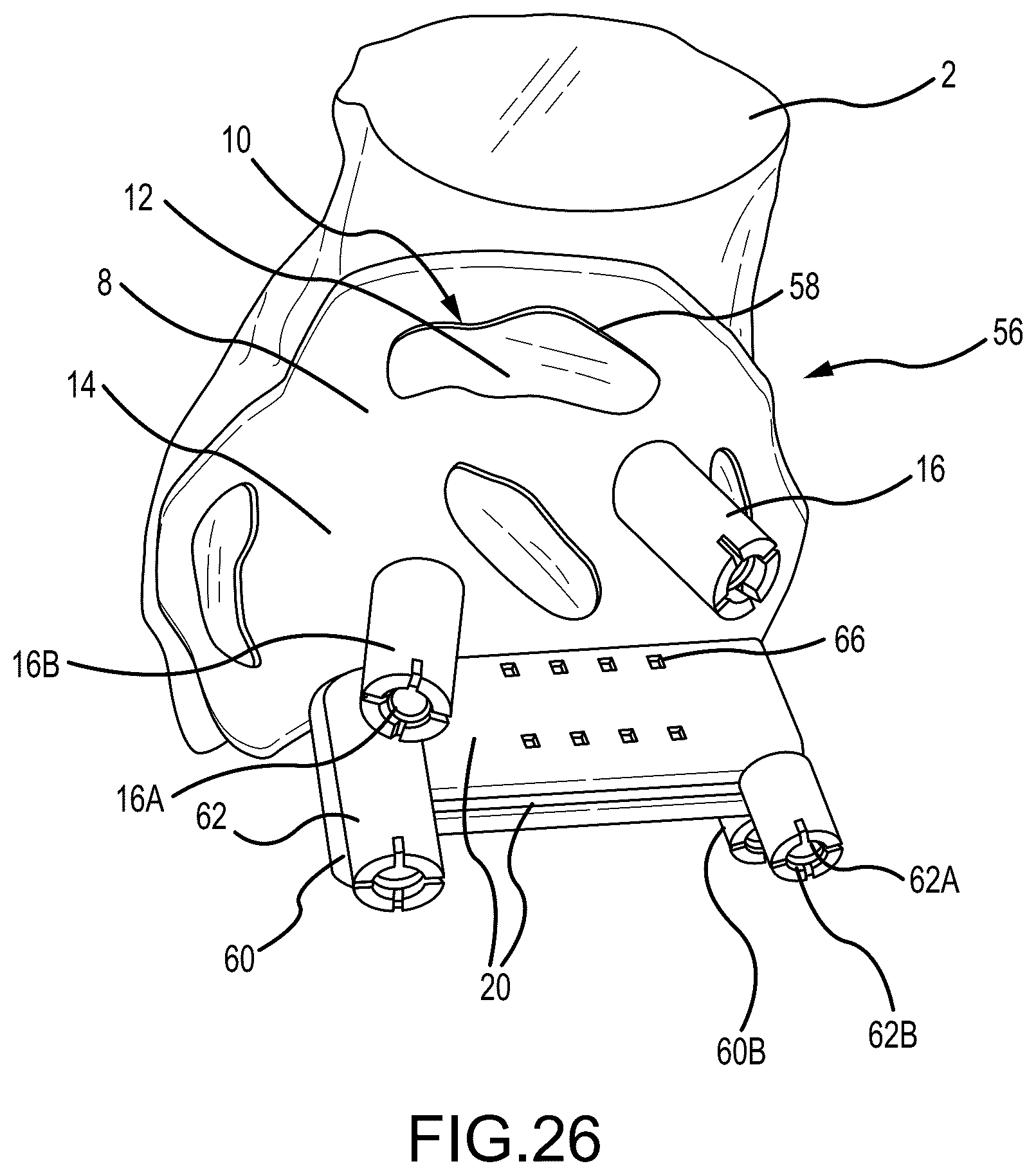 Patent US12324597 Figure 15 – Methods and systems for arthroplasty