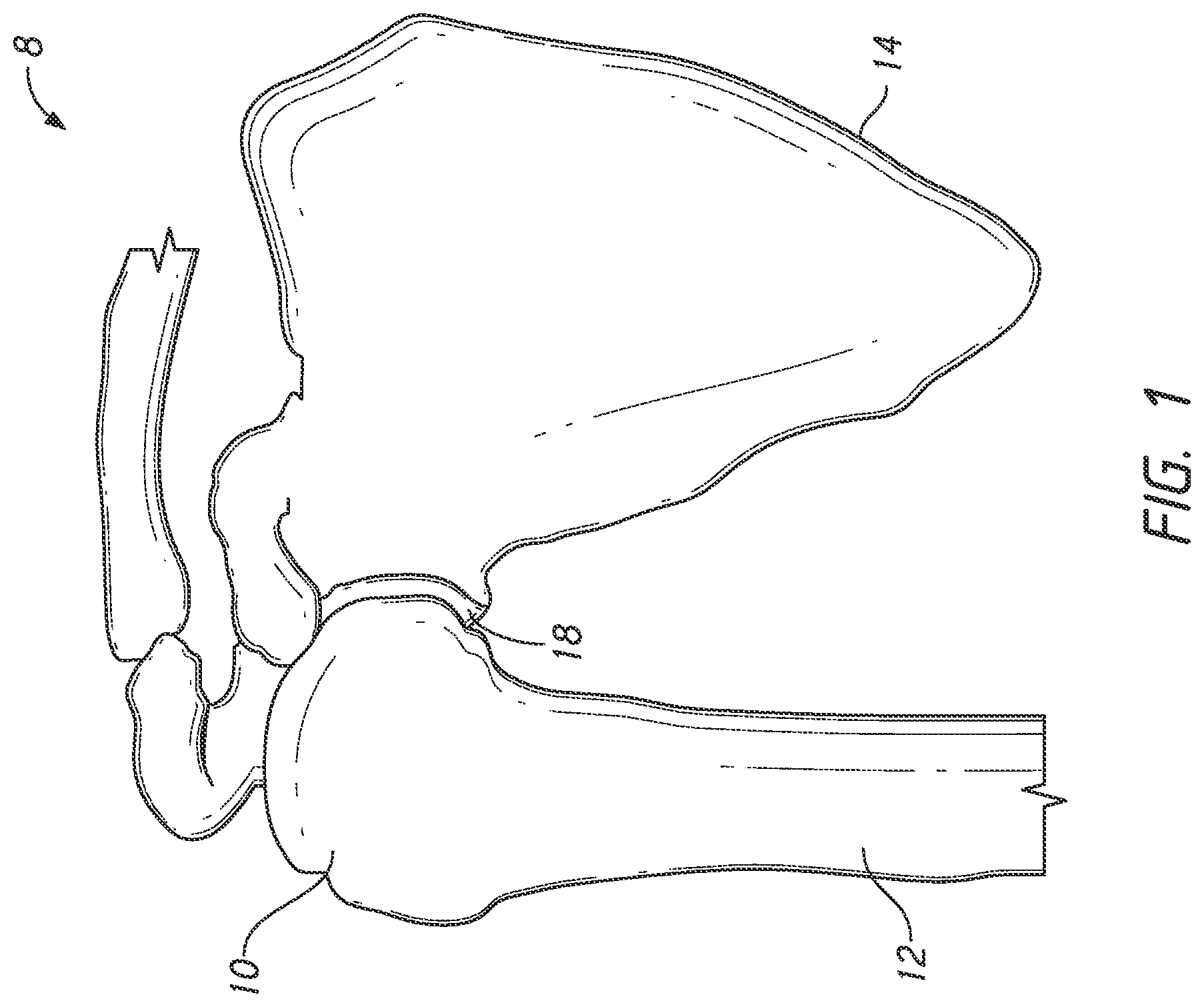 Patent US12324598 Figure 1 – Guides and instruments for improving accuracy of glenoid implant placement