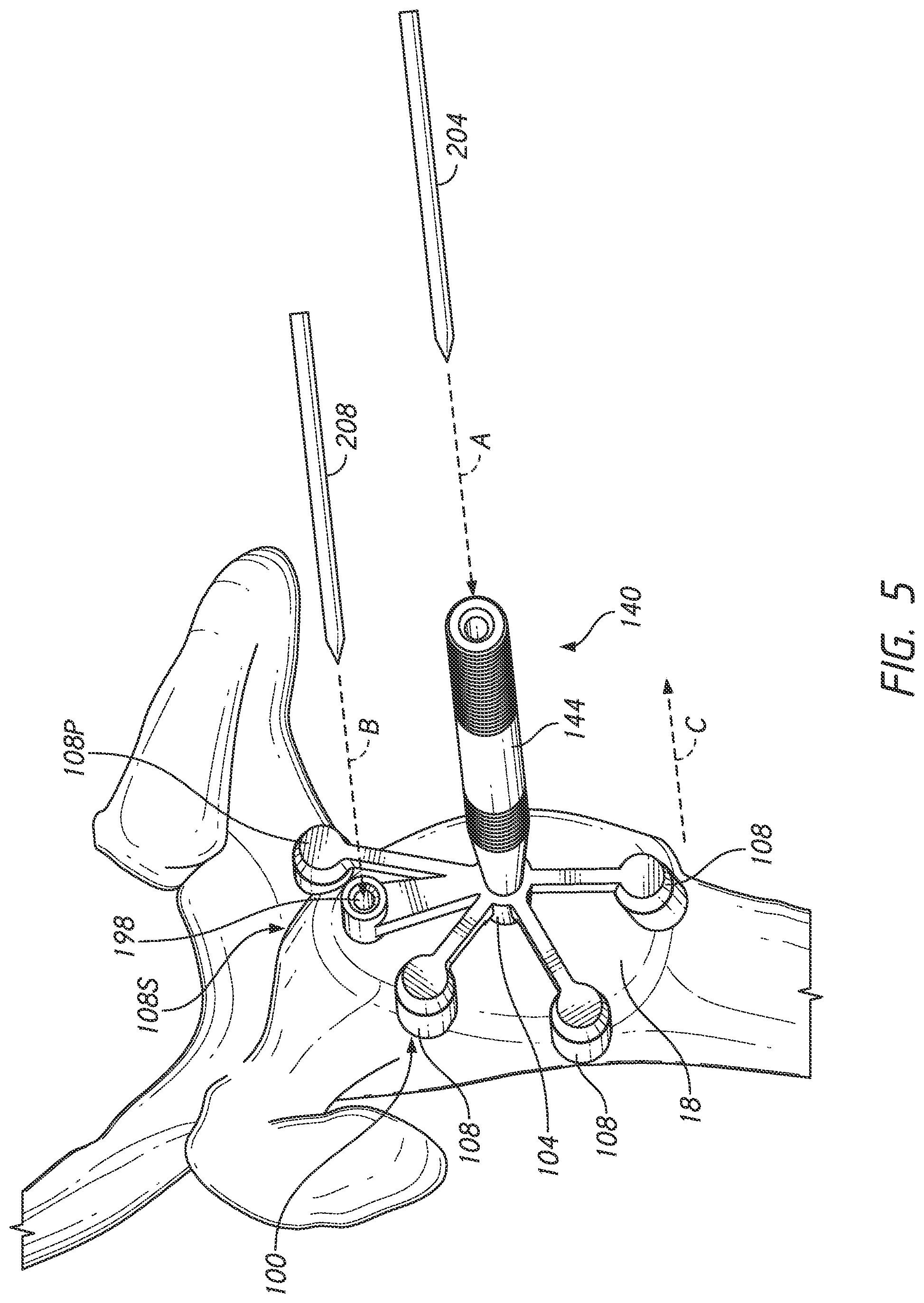 Patent US12324598 Figure 6 – Guides and instruments for improving accuracy of glenoid implant placement