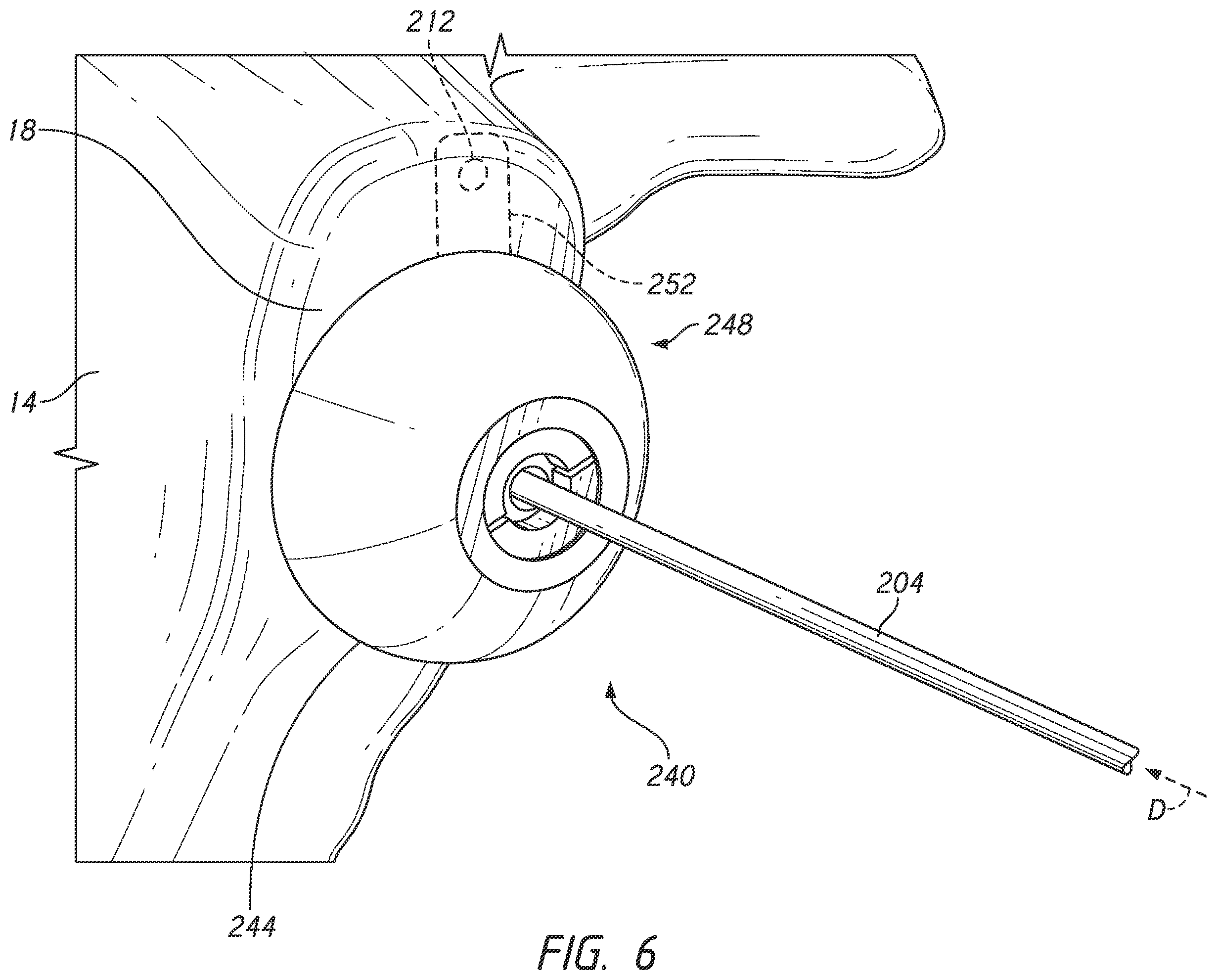 Patent US12324598 Figure 8 – Guides and instruments for improving accuracy of glenoid implant placement