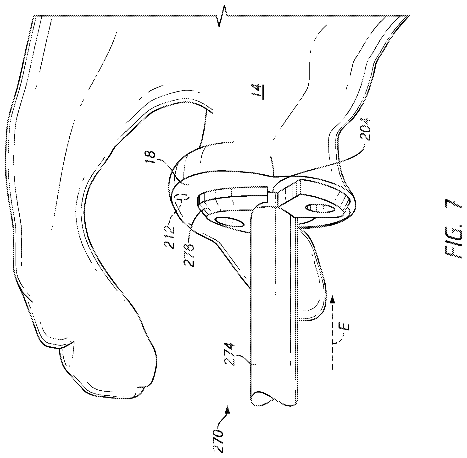 Patent US12324598 Figure 9 – Guides and instruments for improving accuracy of glenoid implant placement