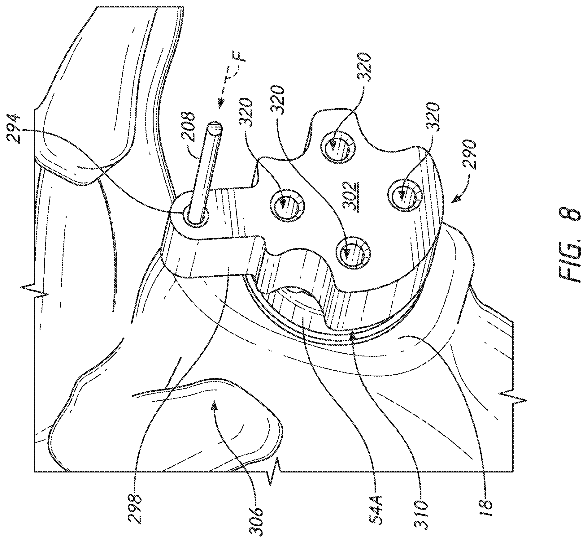 Patent US12324598 Figure 10 – Guides and instruments for improving accuracy of glenoid implant placement