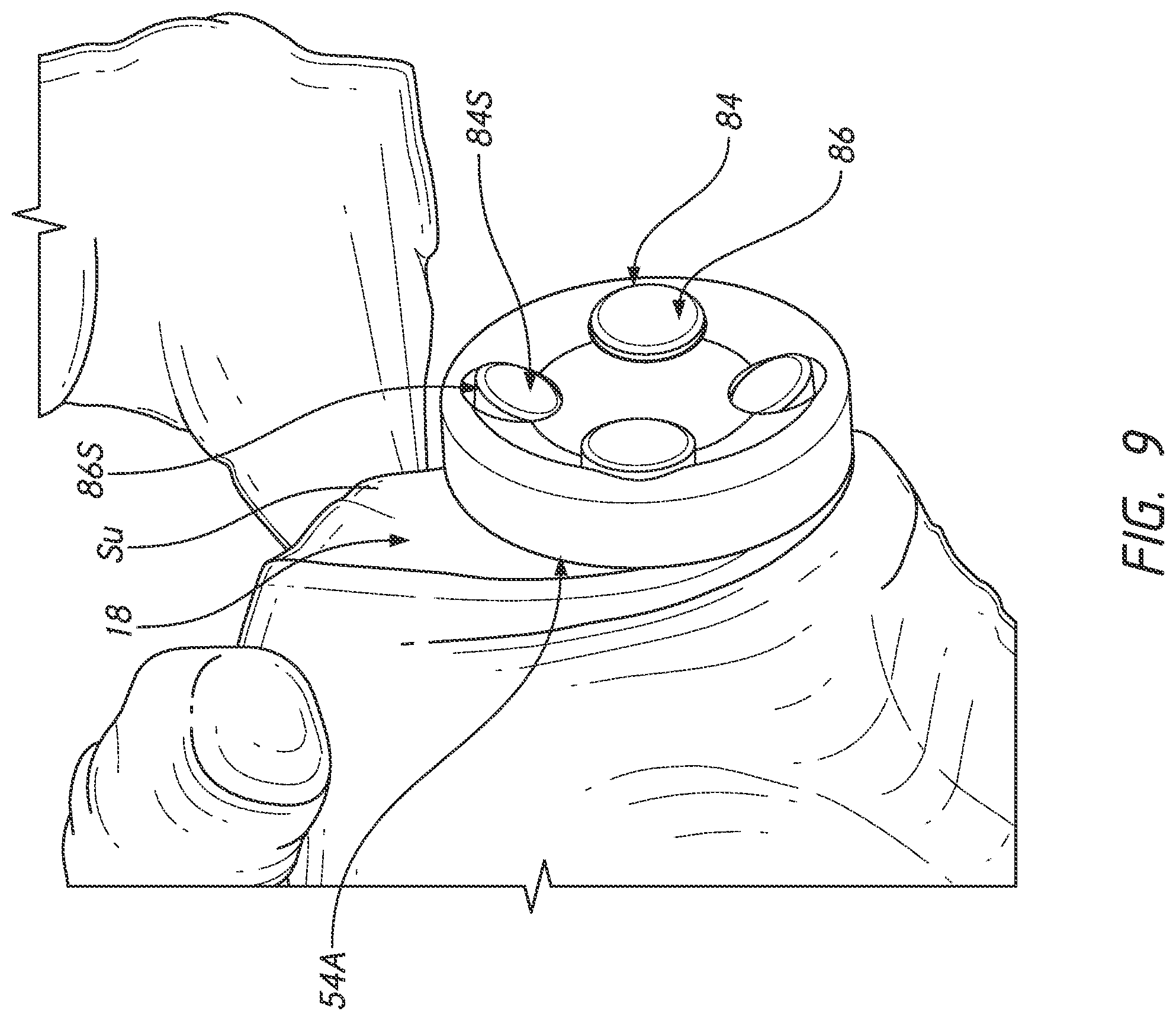 Patent US12324598 Figure 16 – Guides and instruments for improving accuracy of glenoid implant placement