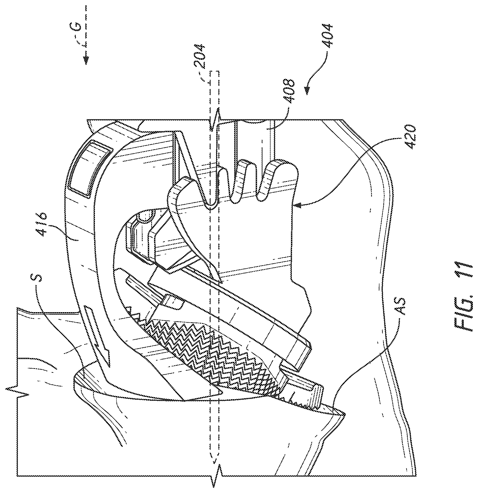 Patent US12324598 Figure 18 – Guides and instruments for improving accuracy of glenoid implant placement
