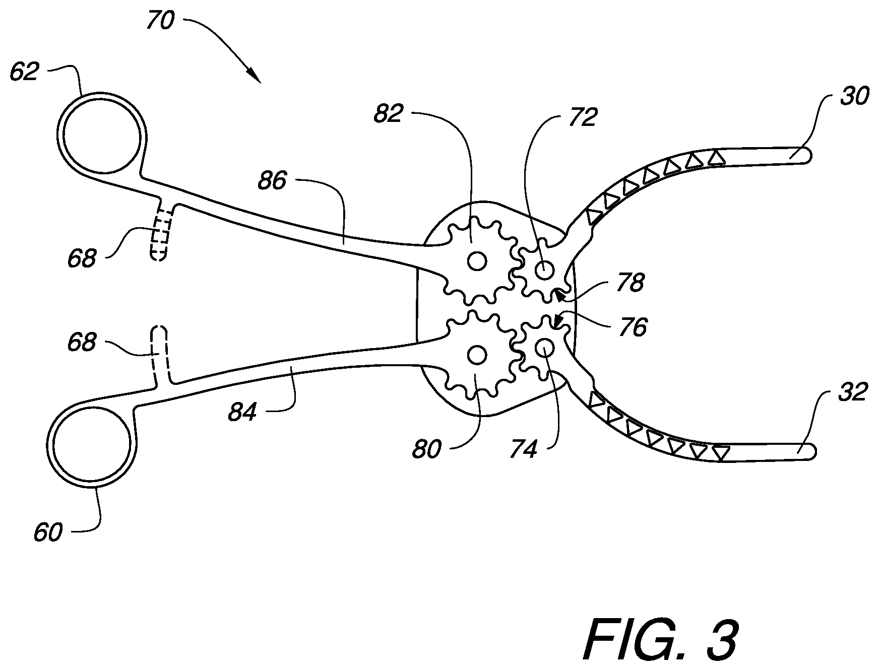 Patent US12324600 Figure 3 – Surgical clamp and clamp jaw