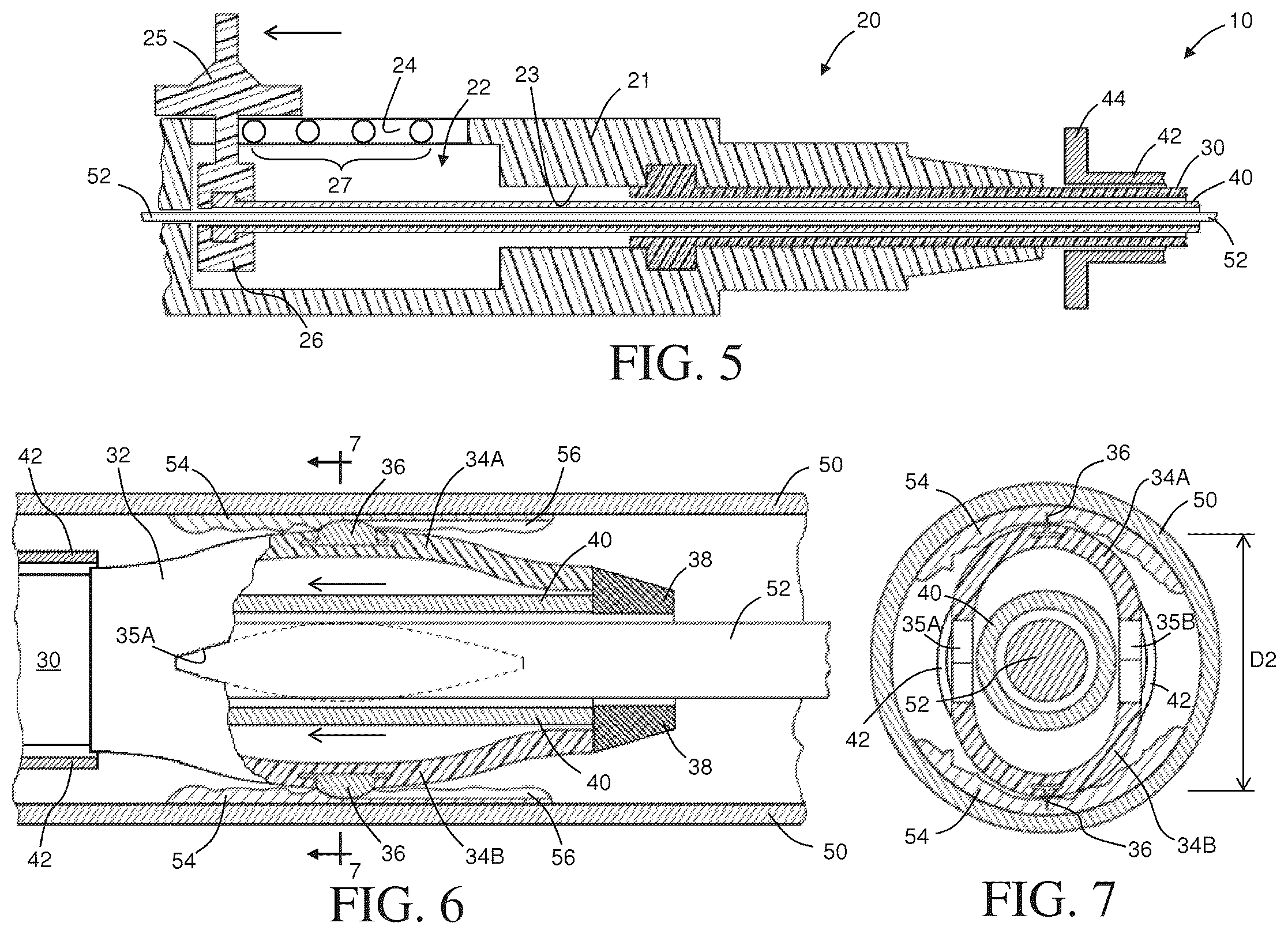Patent US12324603 Figure 3 – Intravascular catheter having an expandable incising portion