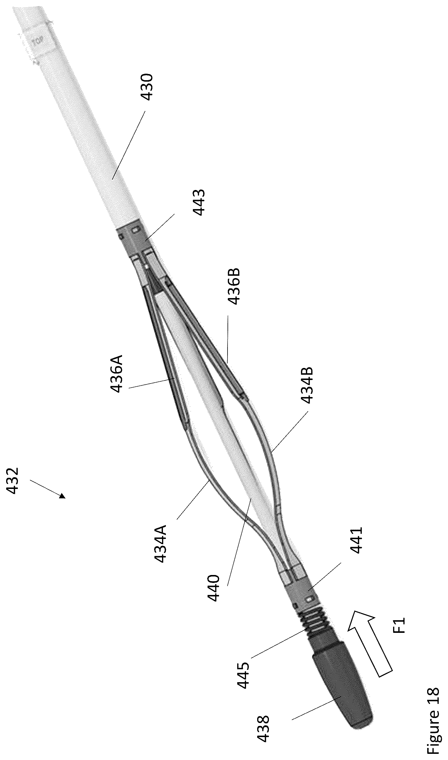 Patent US12324603 Figure 8 – Intravascular catheter having an expandable incising portion