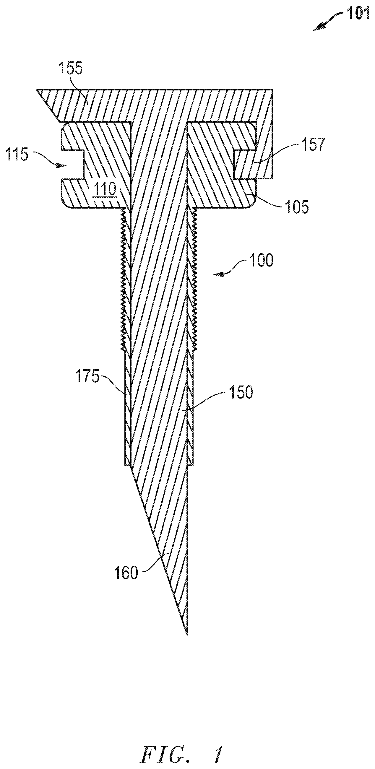 Patent US12324605 Figure 1 – Force fit eye cannula with augmented surface
