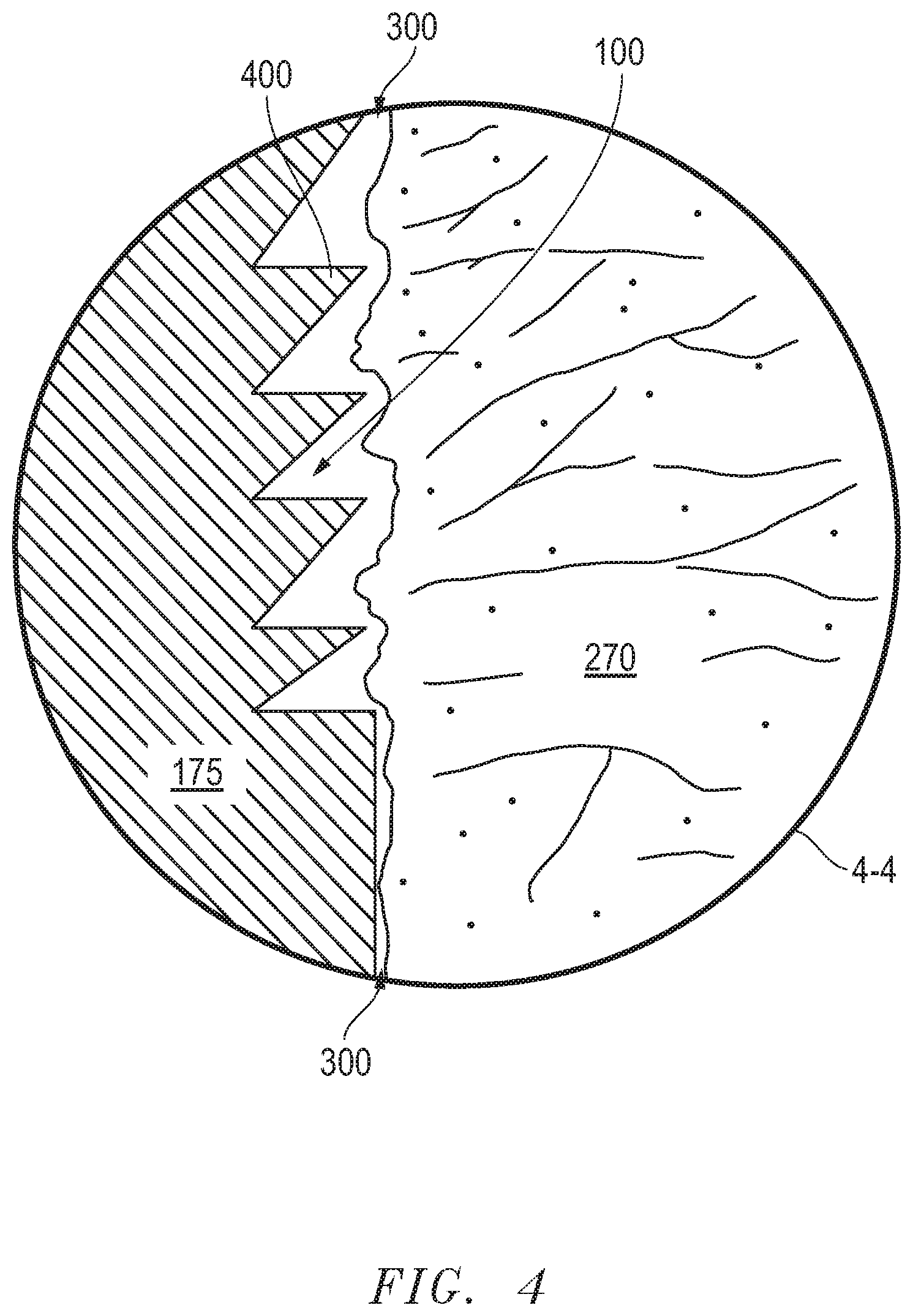 Patent US12324605 Figure 4 – Force fit eye cannula with augmented surface