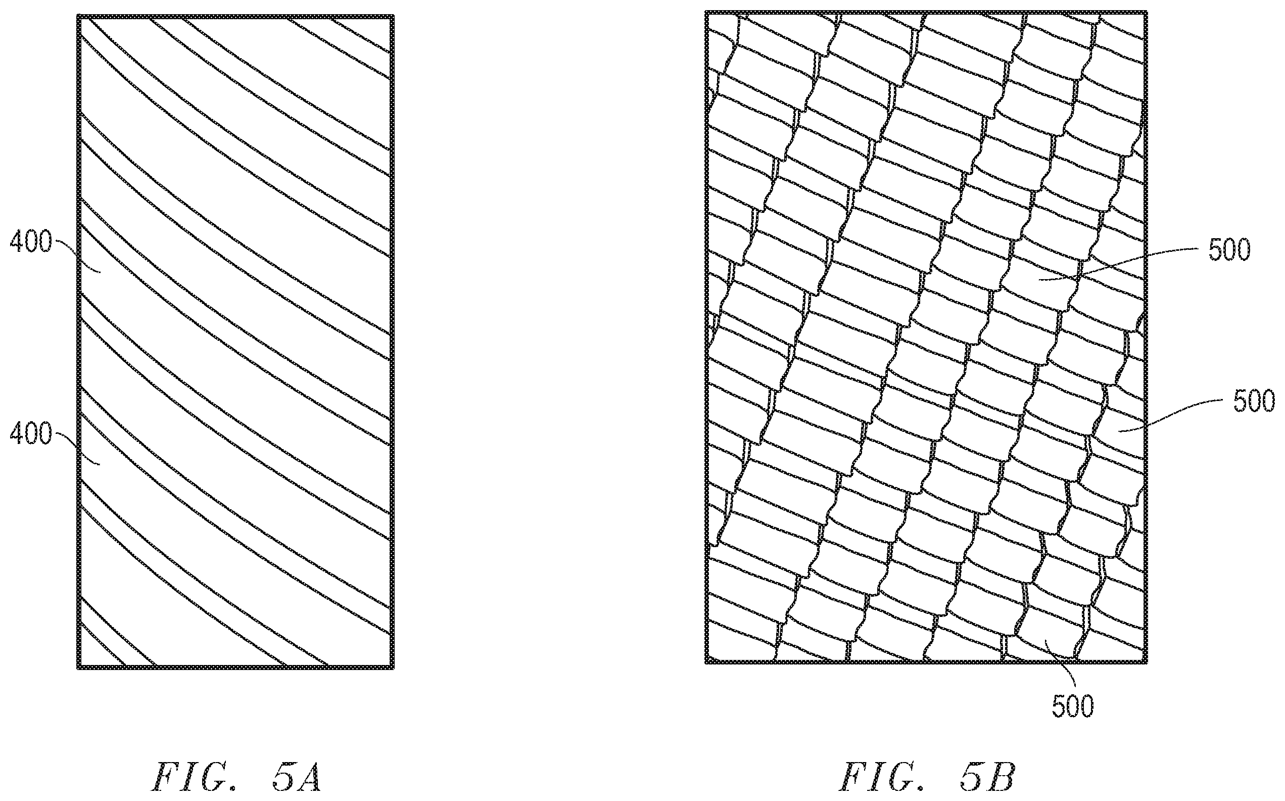 Patent US12324605 Figure 5 – Force fit eye cannula with augmented surface