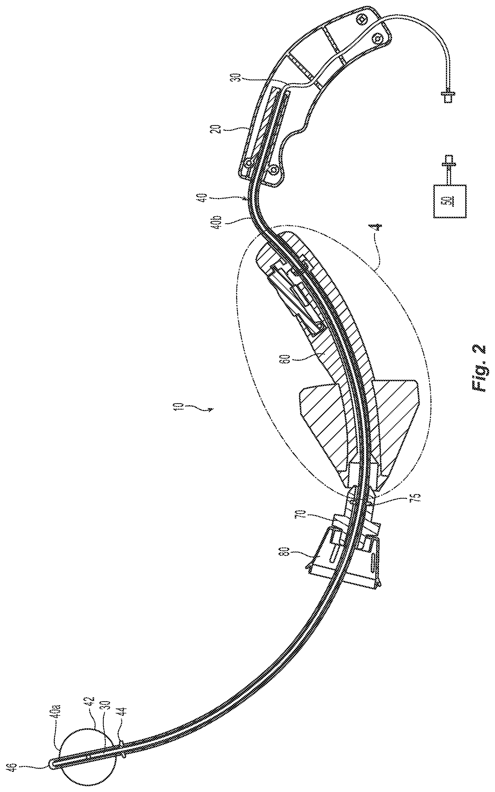 Patent US12324607 Figure 2 – Uterine manipulator with detachable cup and locking occluder