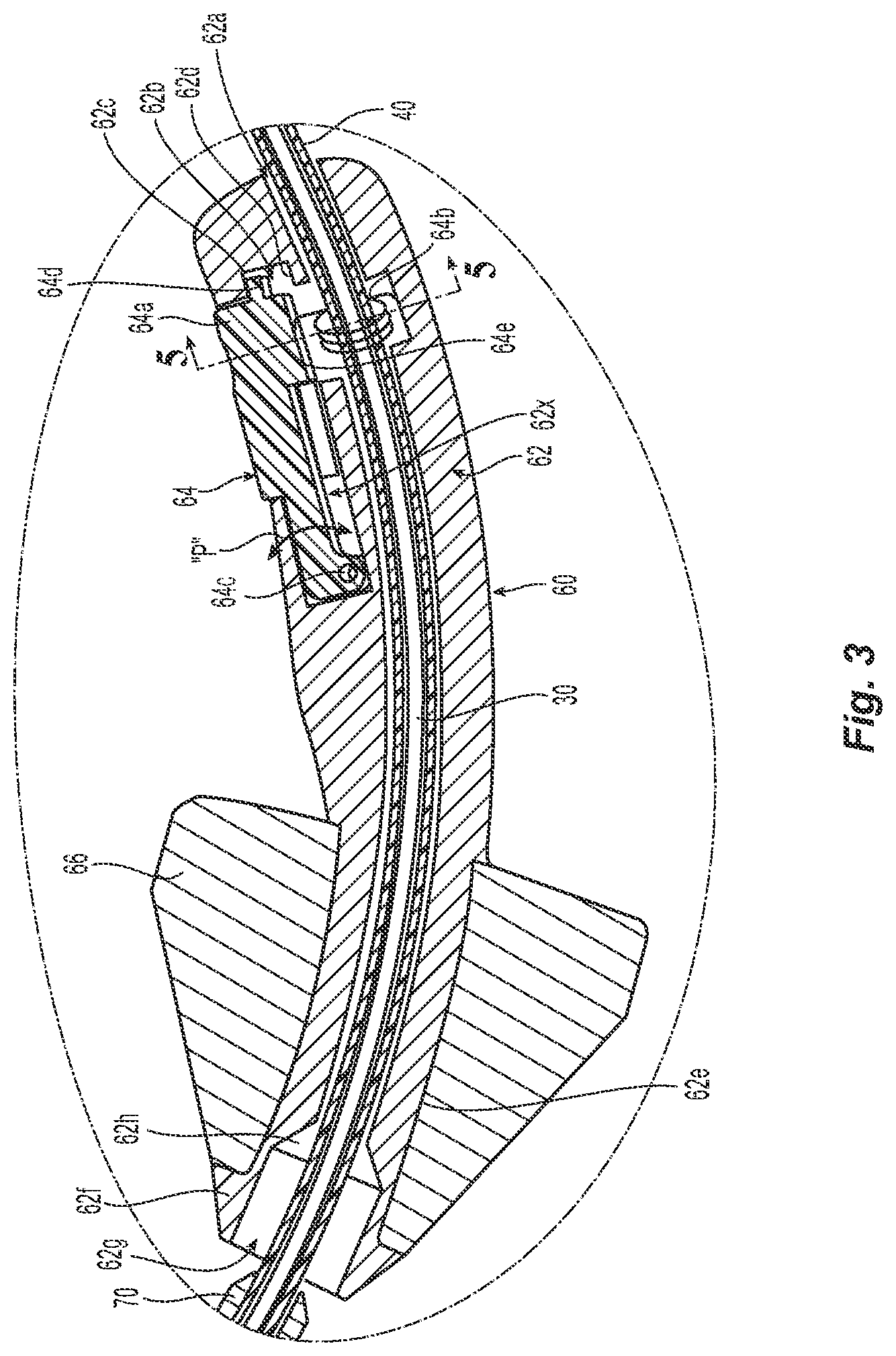 Patent US12324607 Figure 3 – Uterine manipulator with detachable cup and locking occluder