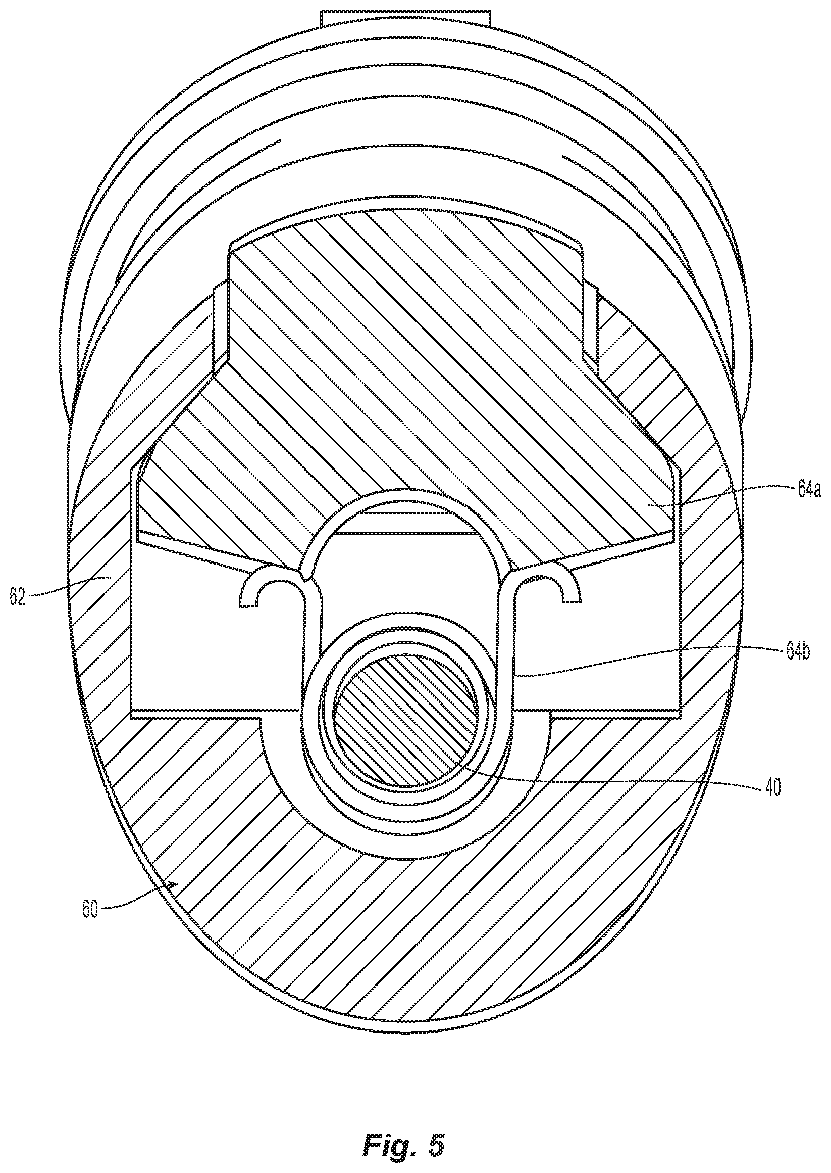 Patent US12324607 Figure 5 – Uterine manipulator with detachable cup and locking occluder
