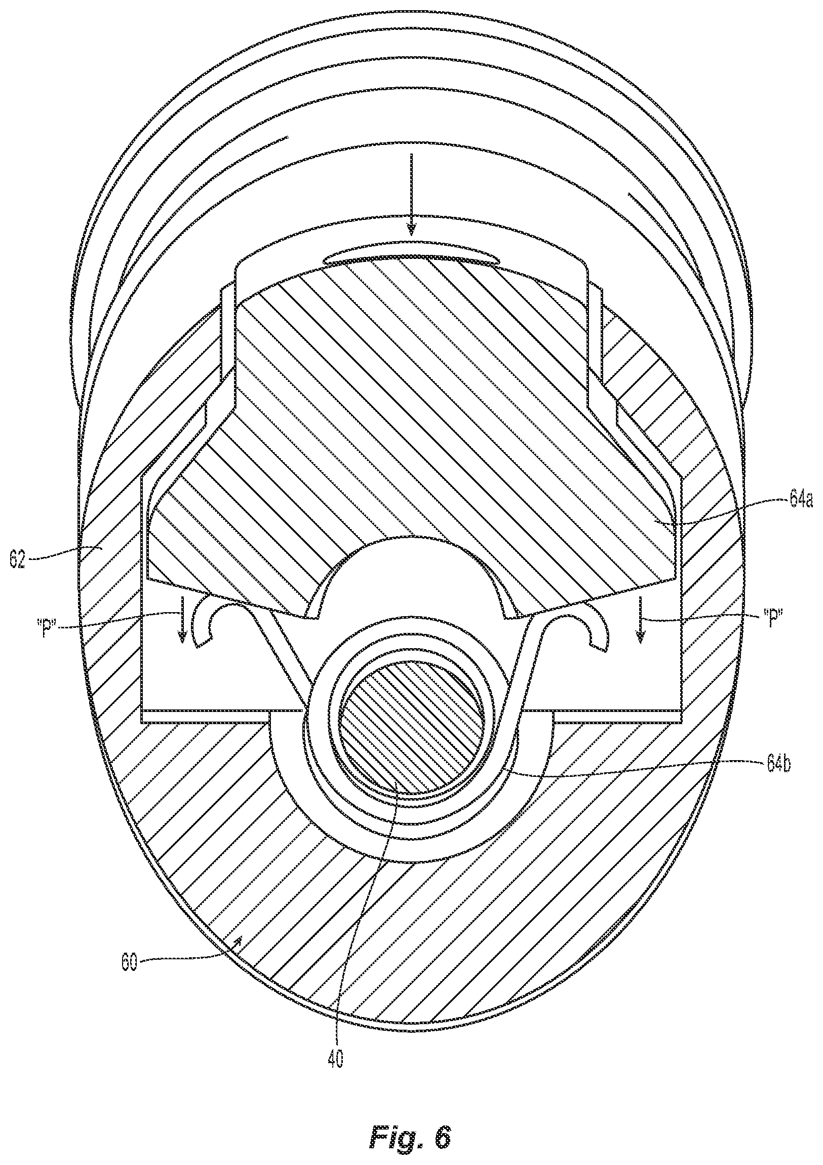 Patent US12324607 Figure 6 – Uterine manipulator with detachable cup and locking occluder