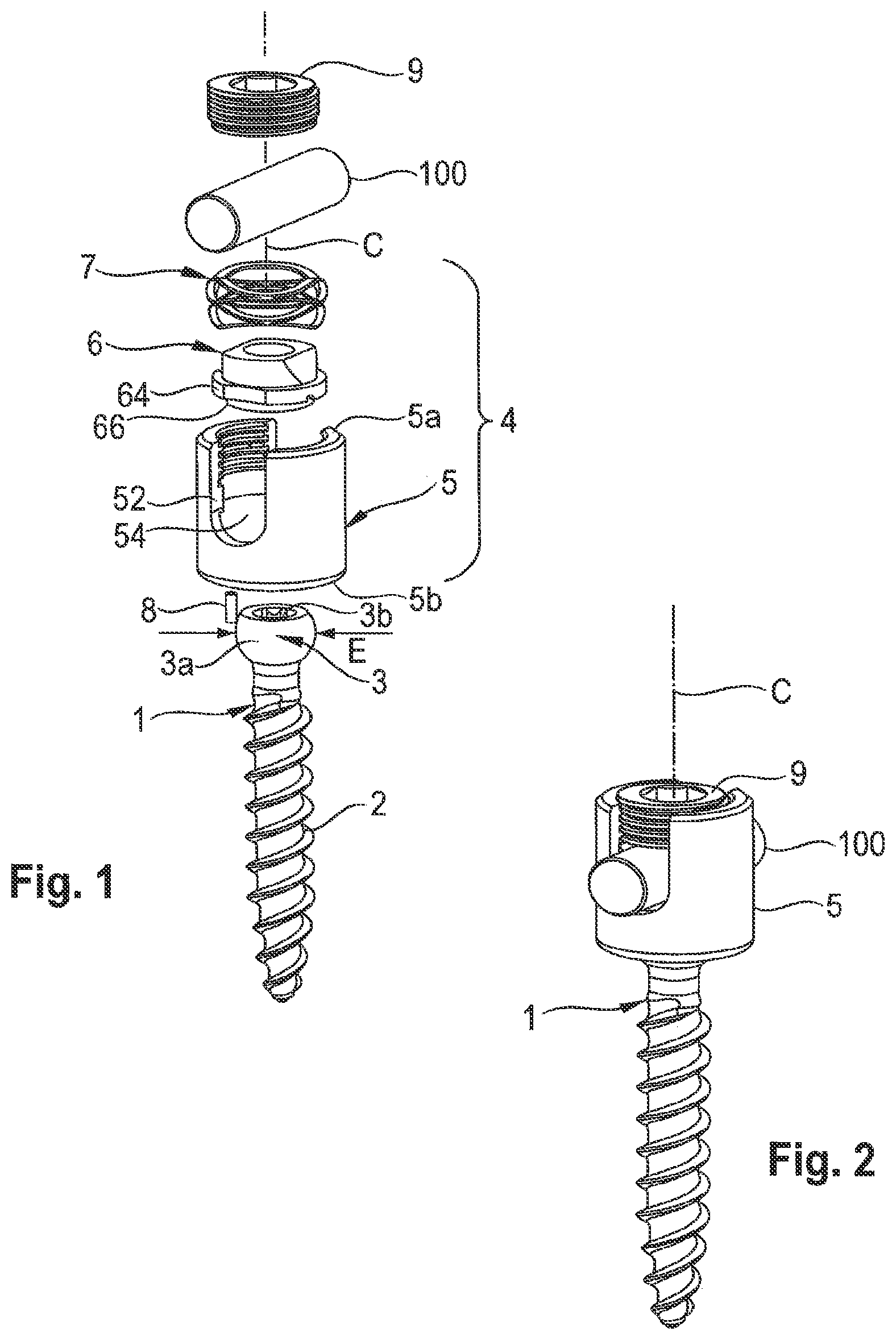 Patent US12324608 Figure 1 – Coupling assembly for coupling a rod to a bone anchoring element, and polyaxial bone anchoring device