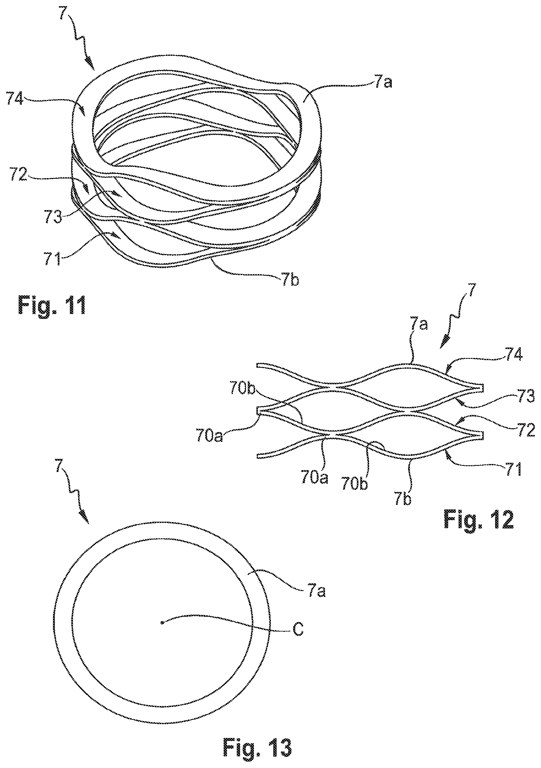 Patent US12324608 Figure 4 – Coupling assembly for coupling a rod to a bone anchoring element, and polyaxial bone anchoring device