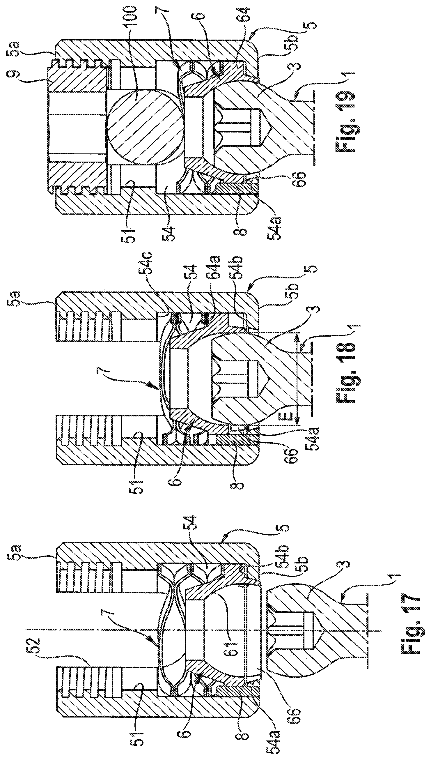 Patent US12324608 Figure 6 – Coupling assembly for coupling a rod to a bone anchoring element, and polyaxial bone anchoring device
