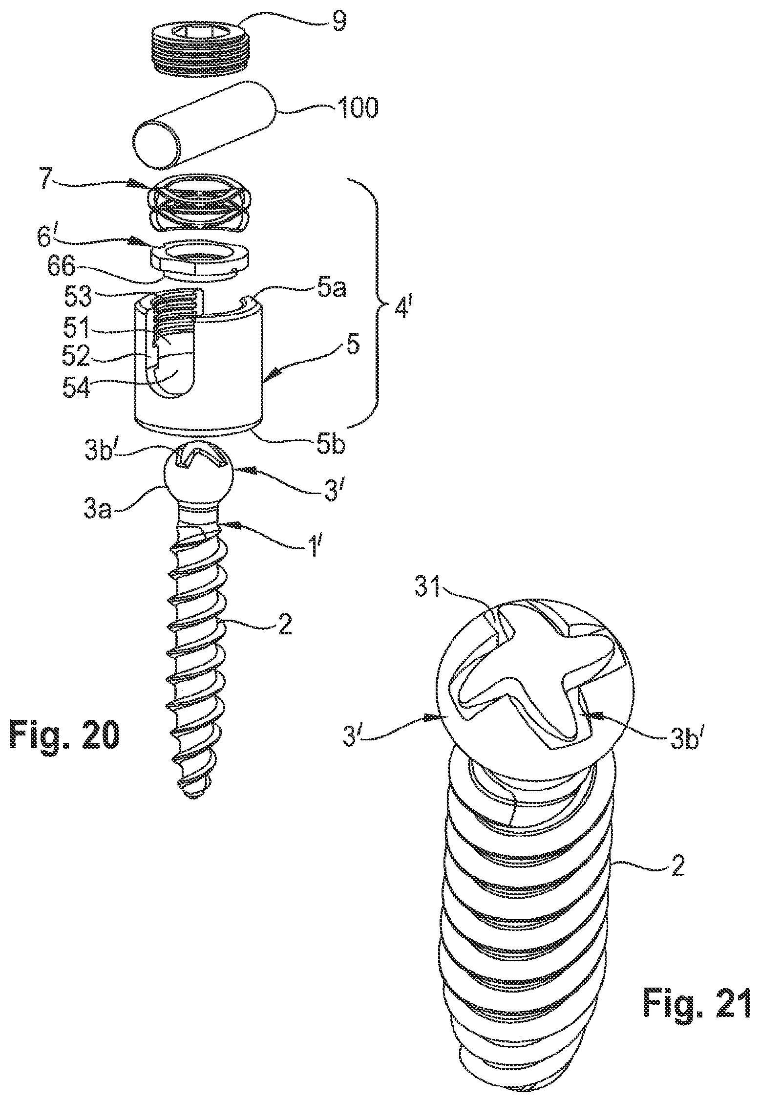 Patent US12324608 Figure 7 – Coupling assembly for coupling a rod to a bone anchoring element, and polyaxial bone anchoring device