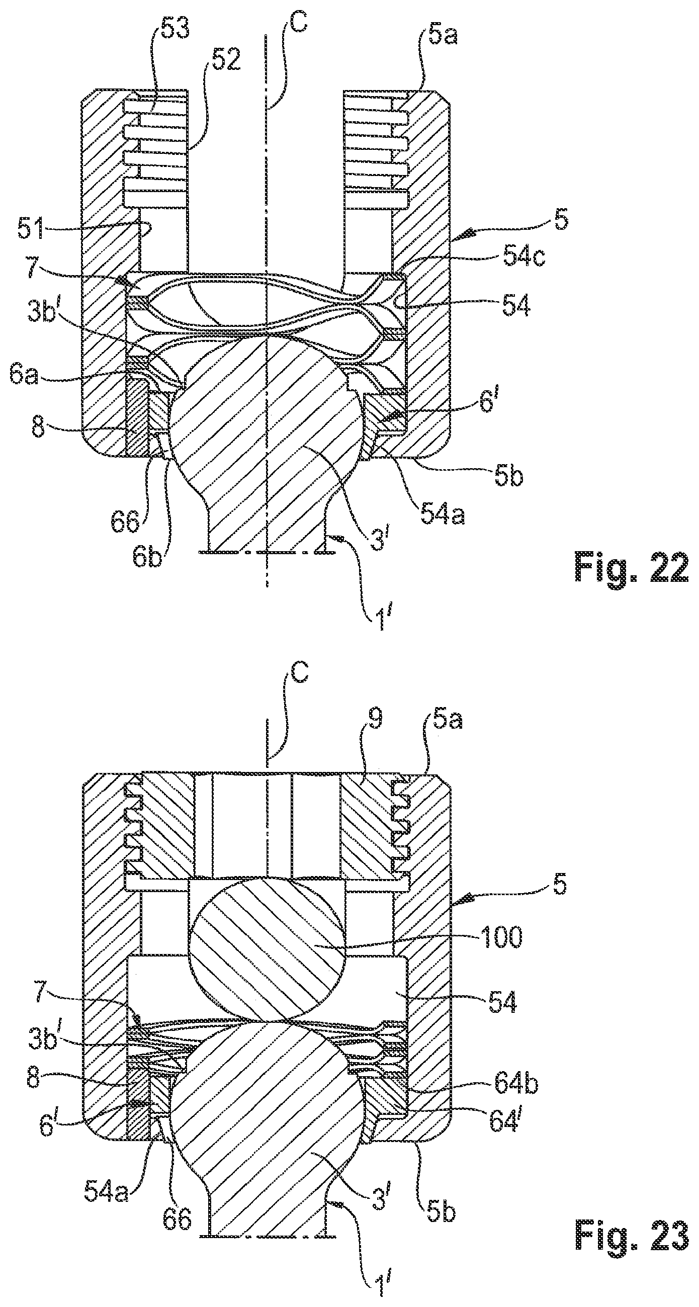 Patent US12324608 Figure 8 – Coupling assembly for coupling a rod to a bone anchoring element, and polyaxial bone anchoring device