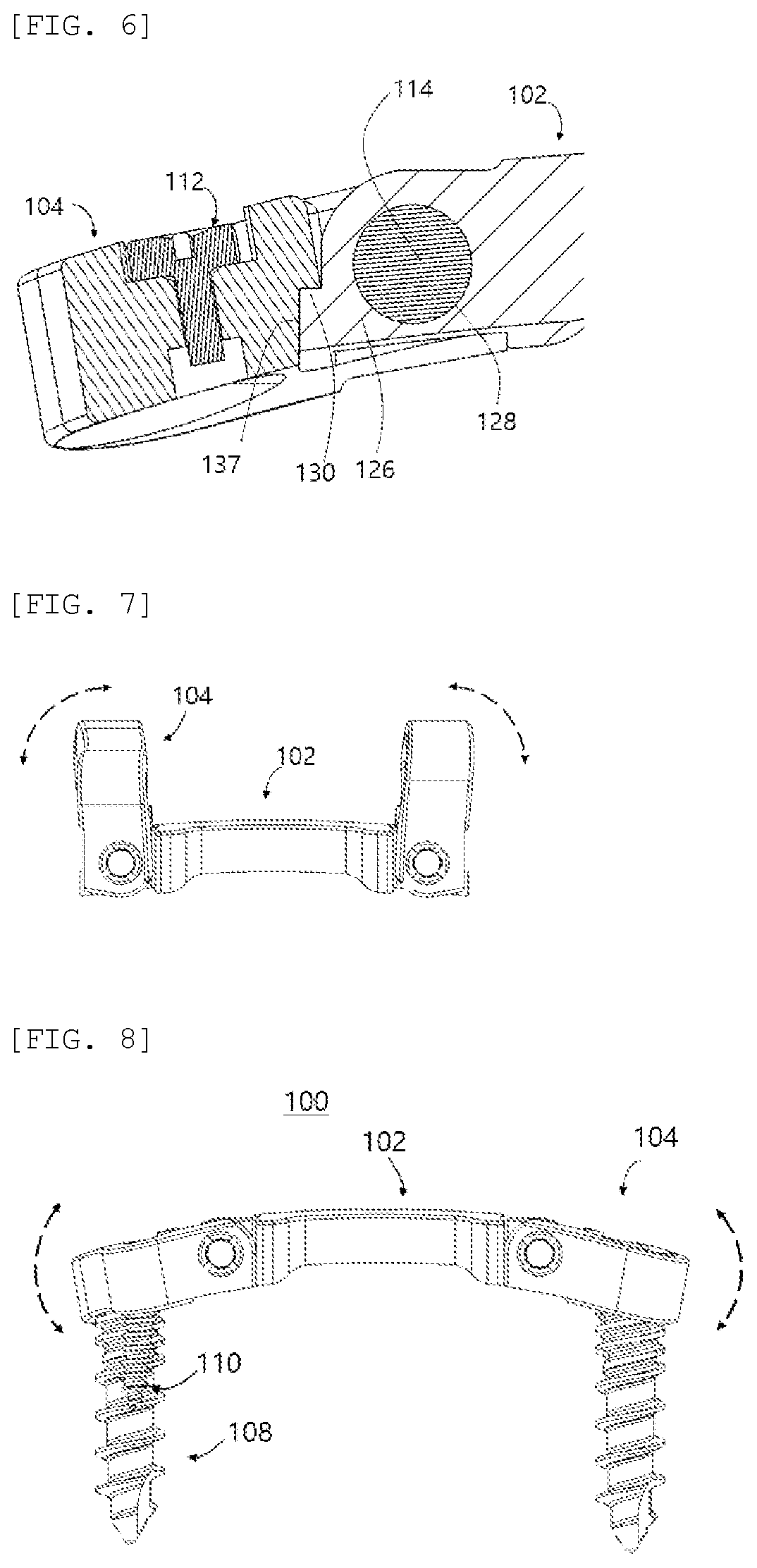 Patent US12324609 Figure 3 – Adjustable spinal plate