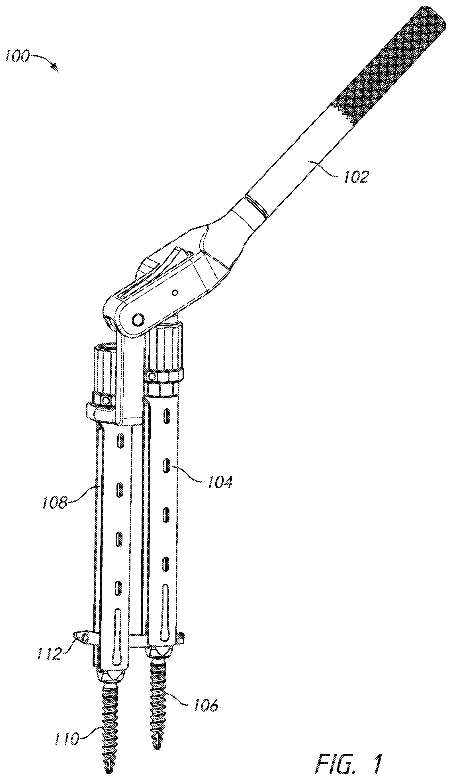 Patent US12324610 — Lever reducer — Figure 1