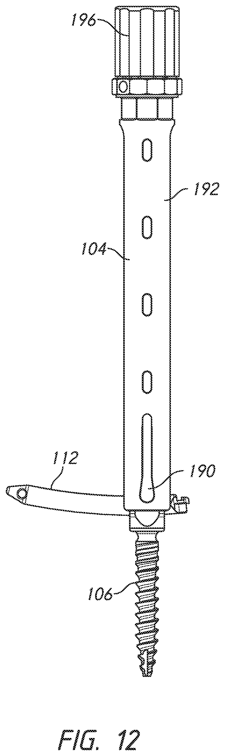 Patent US12324610 Figure 12 – Lever reducer