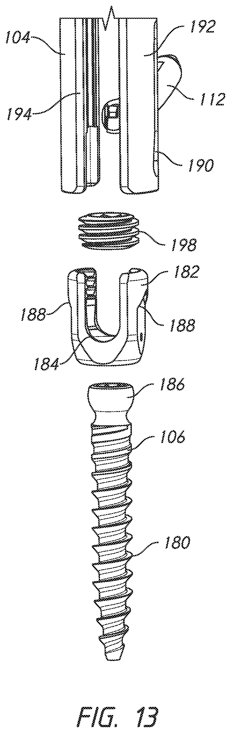 Patent US12324610 Figure 13 – Lever reducer
