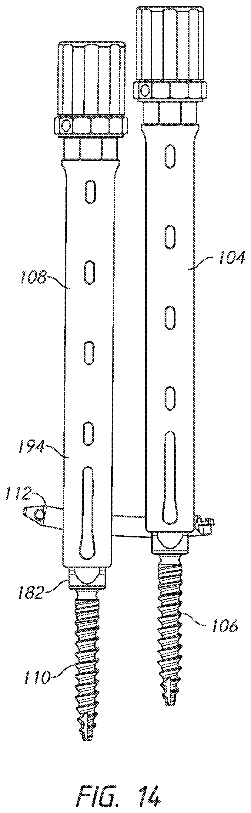 Patent US12324610 Figure 14 – Lever reducer