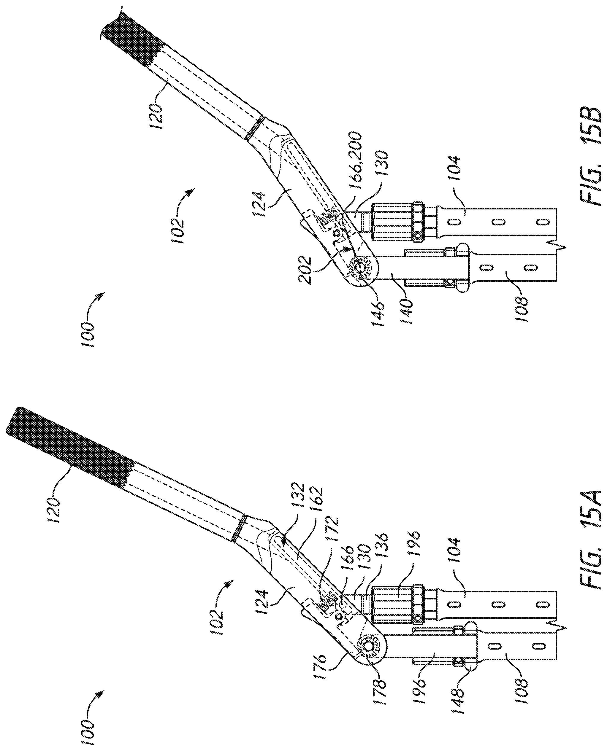 Patent US12324610 Figure 15 – Lever reducer